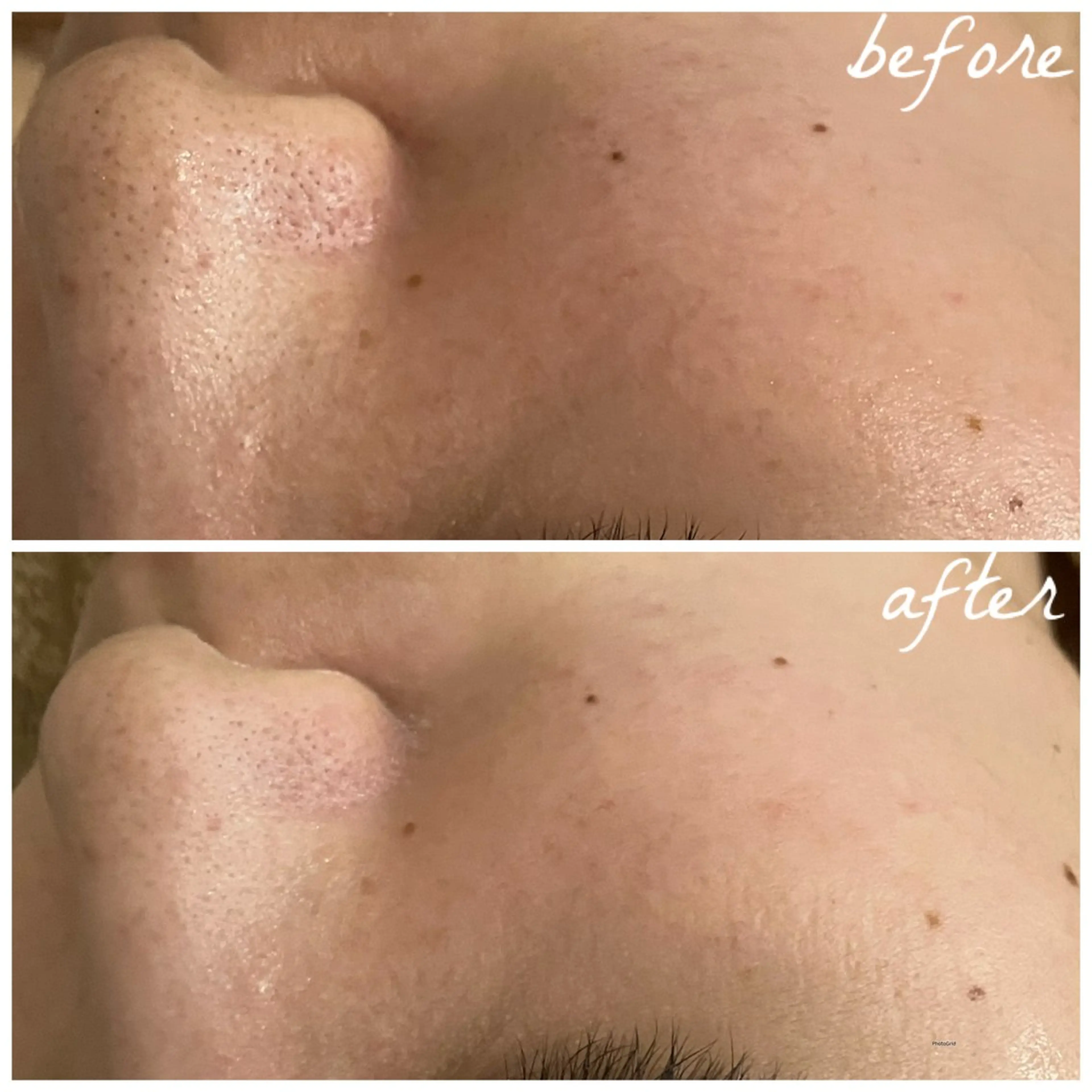 メンズ エステ メナード岐阜茜部 杉浦のエステ・リラクイメージ