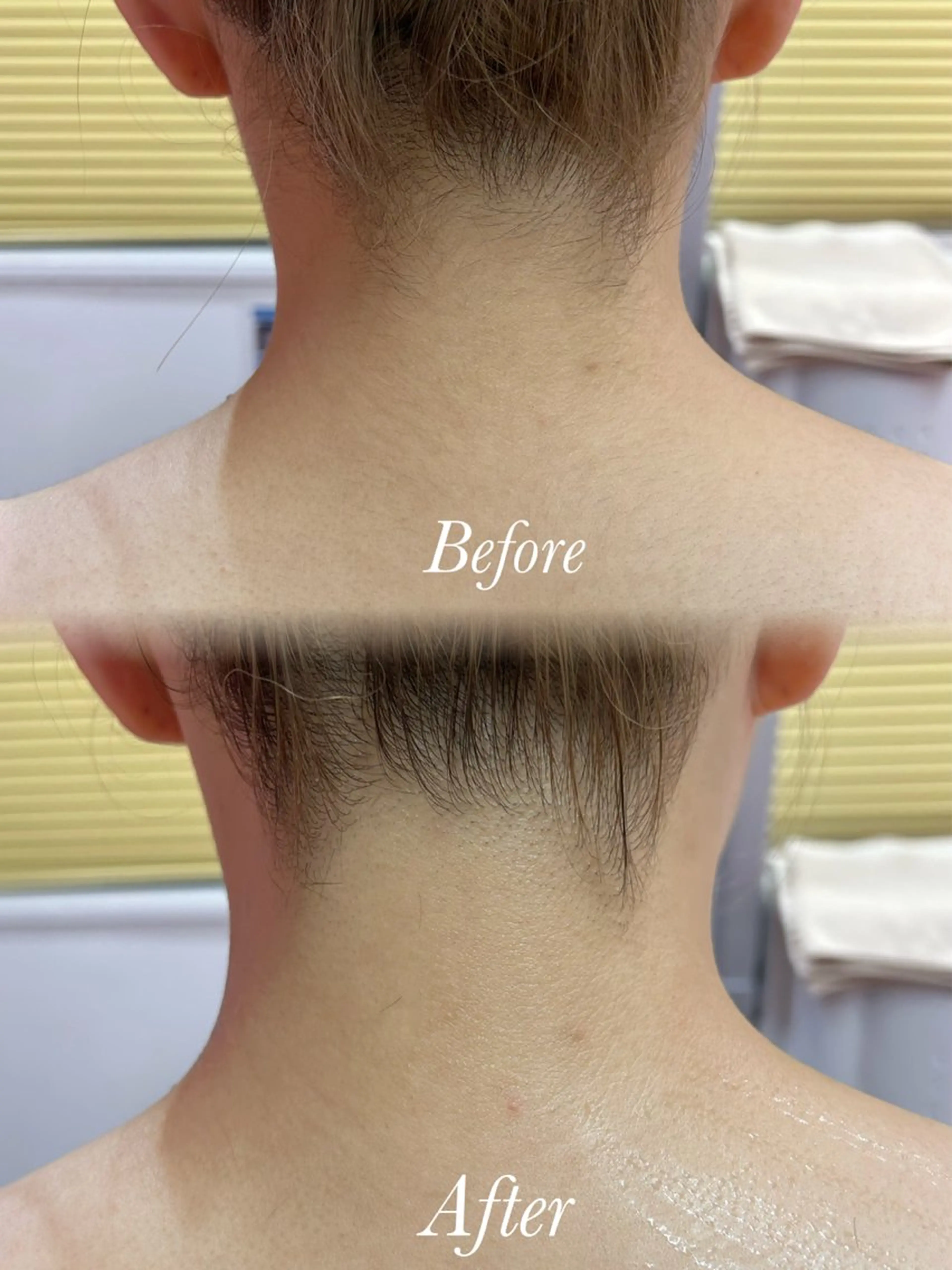 🫧美しい素肌へ🫧 今成柚乃のその他イメージ