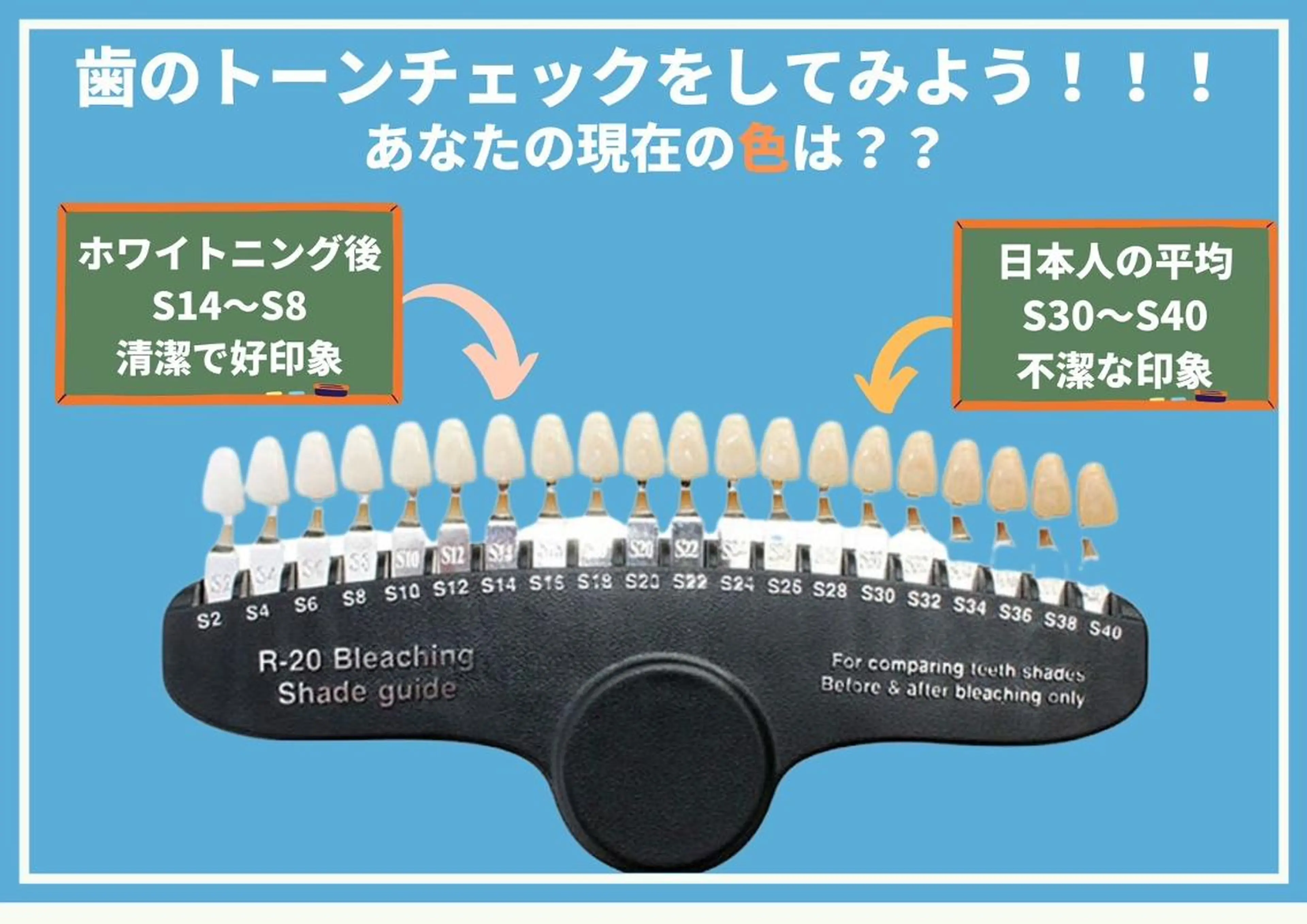 歯のホワイトニング HARU南浦和のその他イメージ