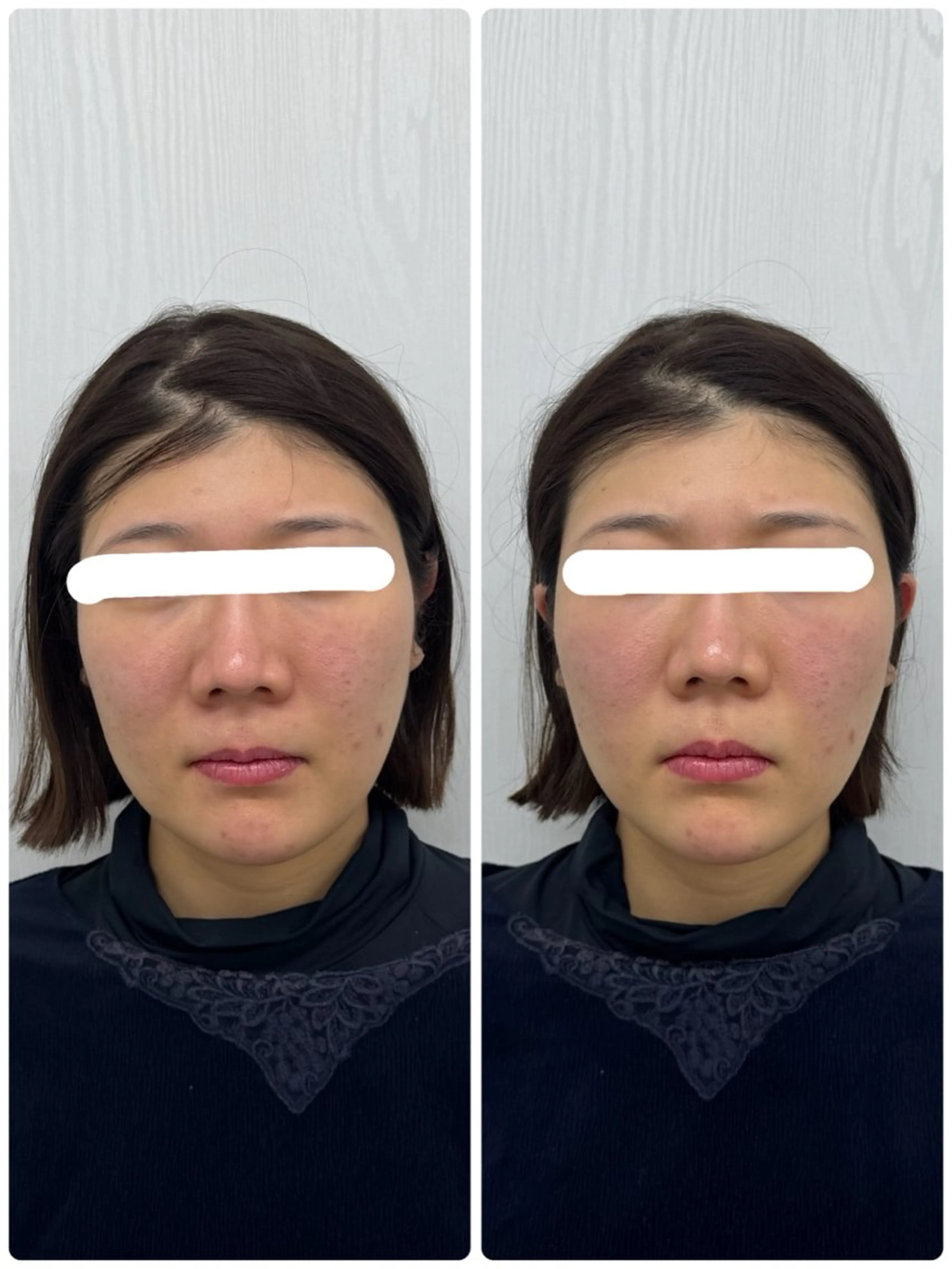 エステ リラク 美容鍼×小顔矯正 ×美容整体　浜川泰仁のエステ・リラクイメージ