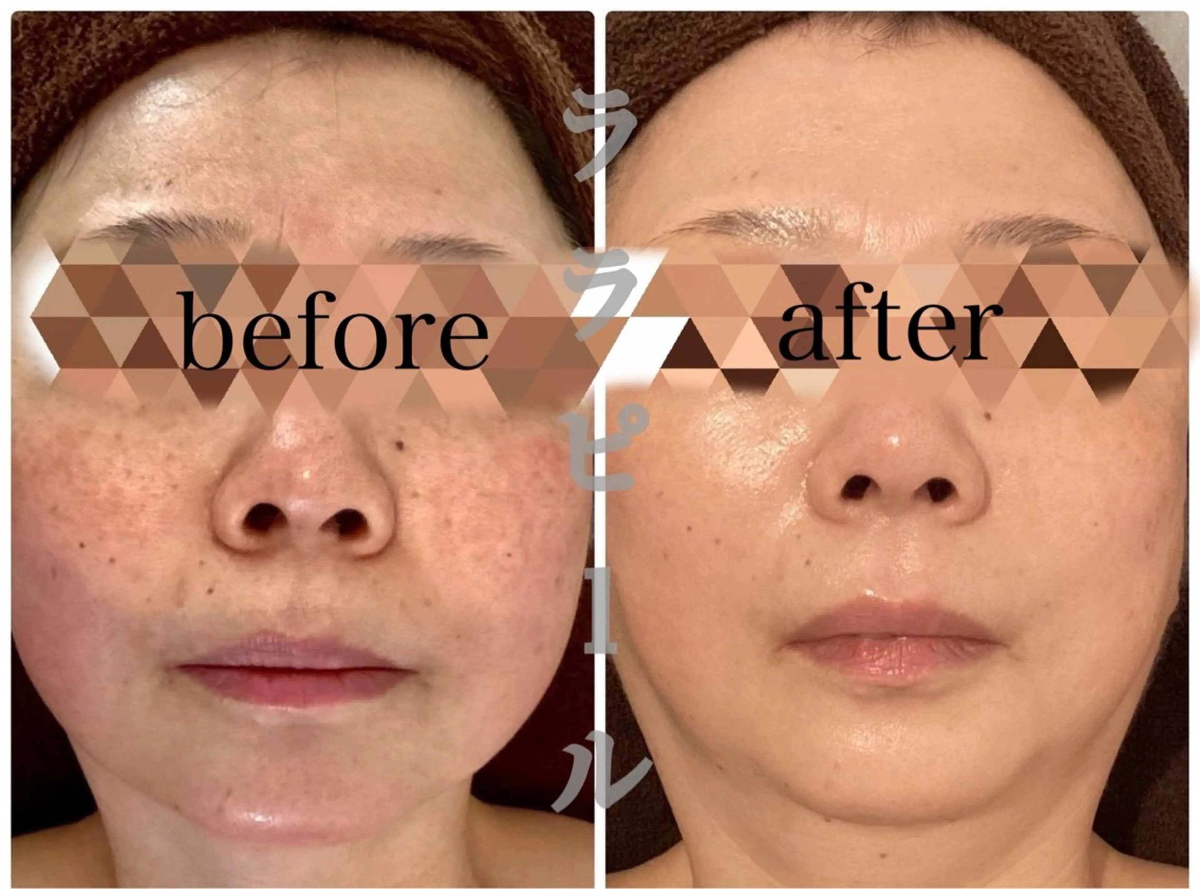 EstheticSalonReTweet所属・Esthetic ReTweetのエステ・リラクイメージ