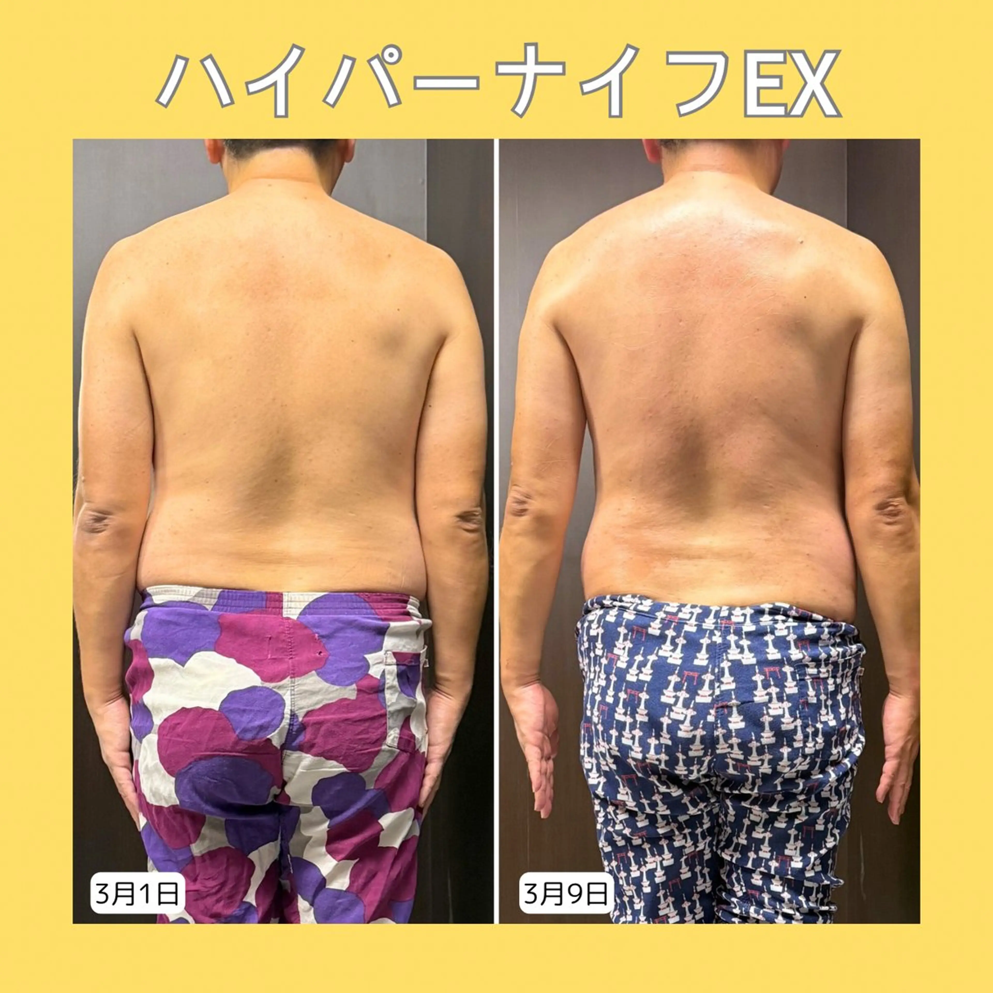 エステ 赤澤/本気痩せ・脱毛 ・ノーファンデ肌のその他イメージ