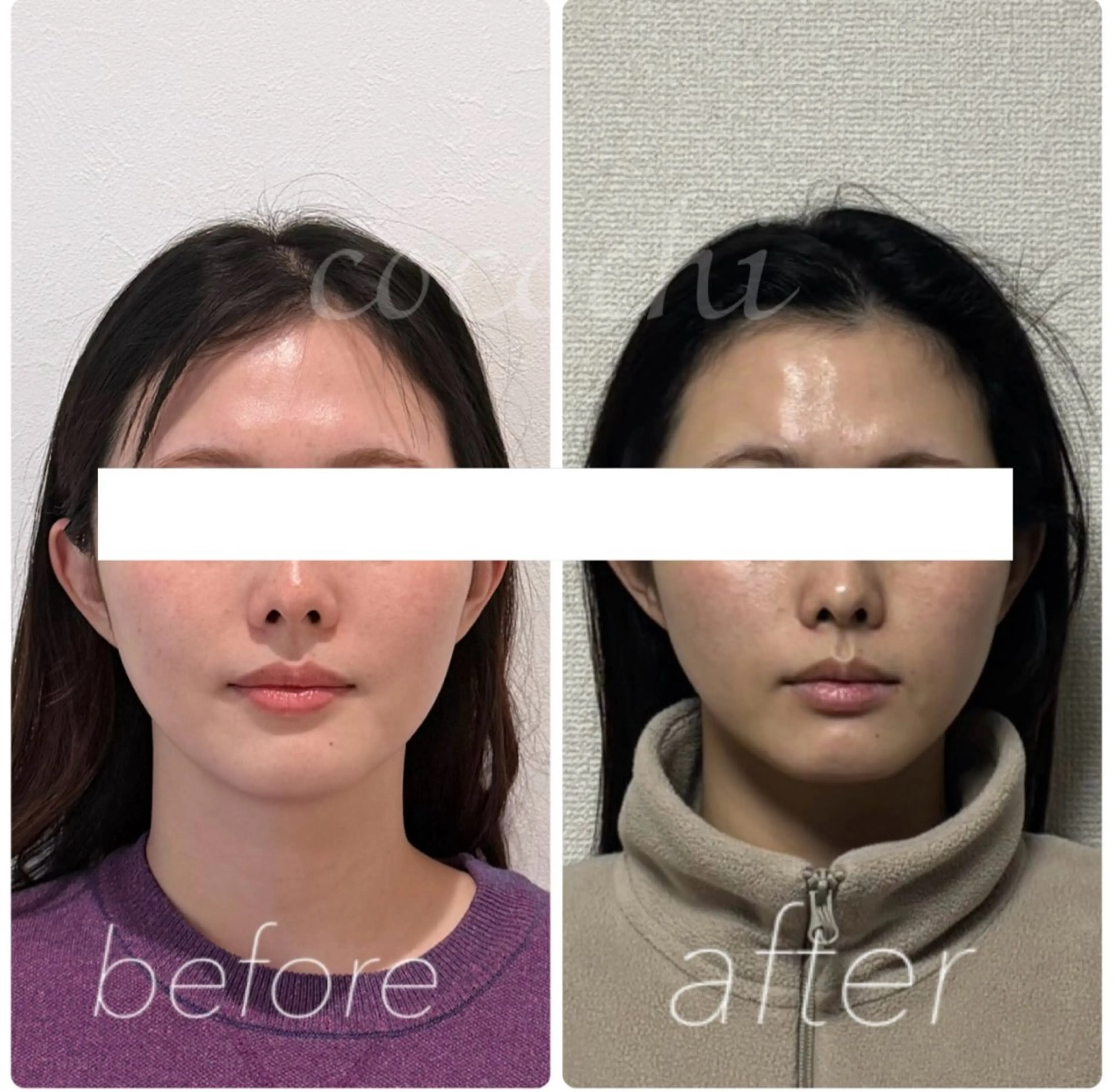 エステ リラク 小顔と ヘッドスパのお店のエステ・リラクイメージ