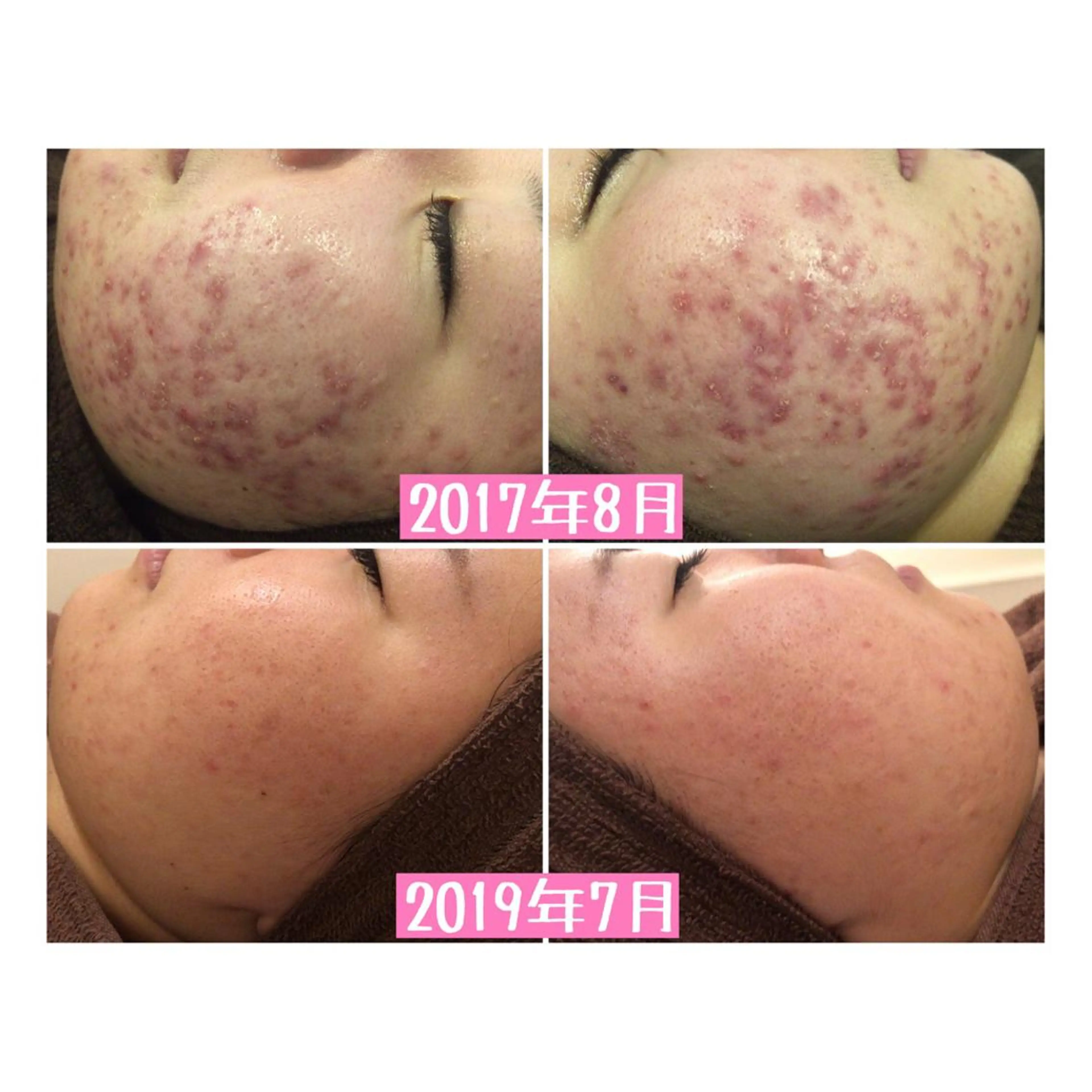 ショート カラー パーマ ヘアアレンジ メンズ キッズ ネイル マツエク・マツパ エステ リラク ニキビ・肌質改善専門 ♡人生が変わるサロンのエステ・リラクイメージ