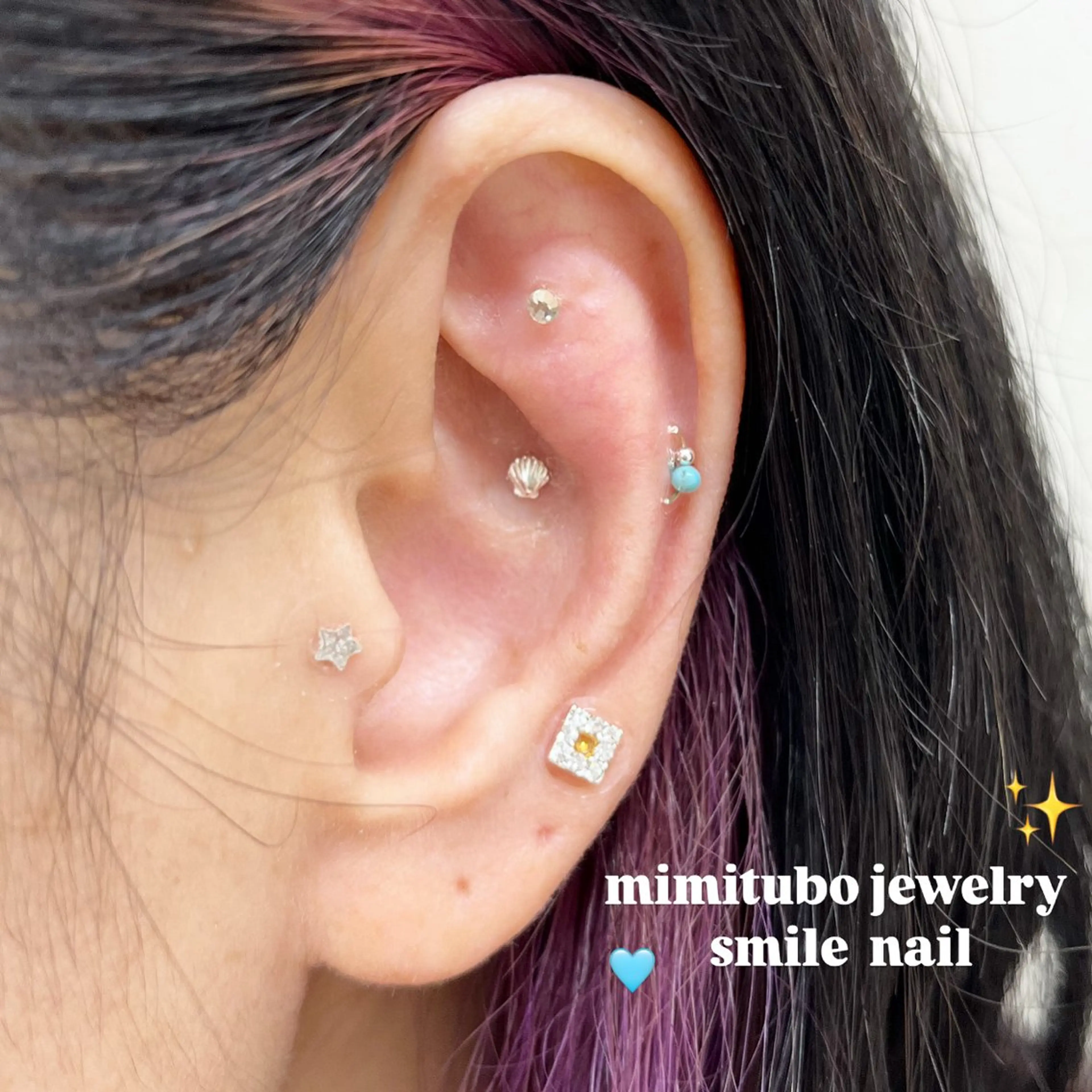 smileskin 京都／meguのその他イメージ