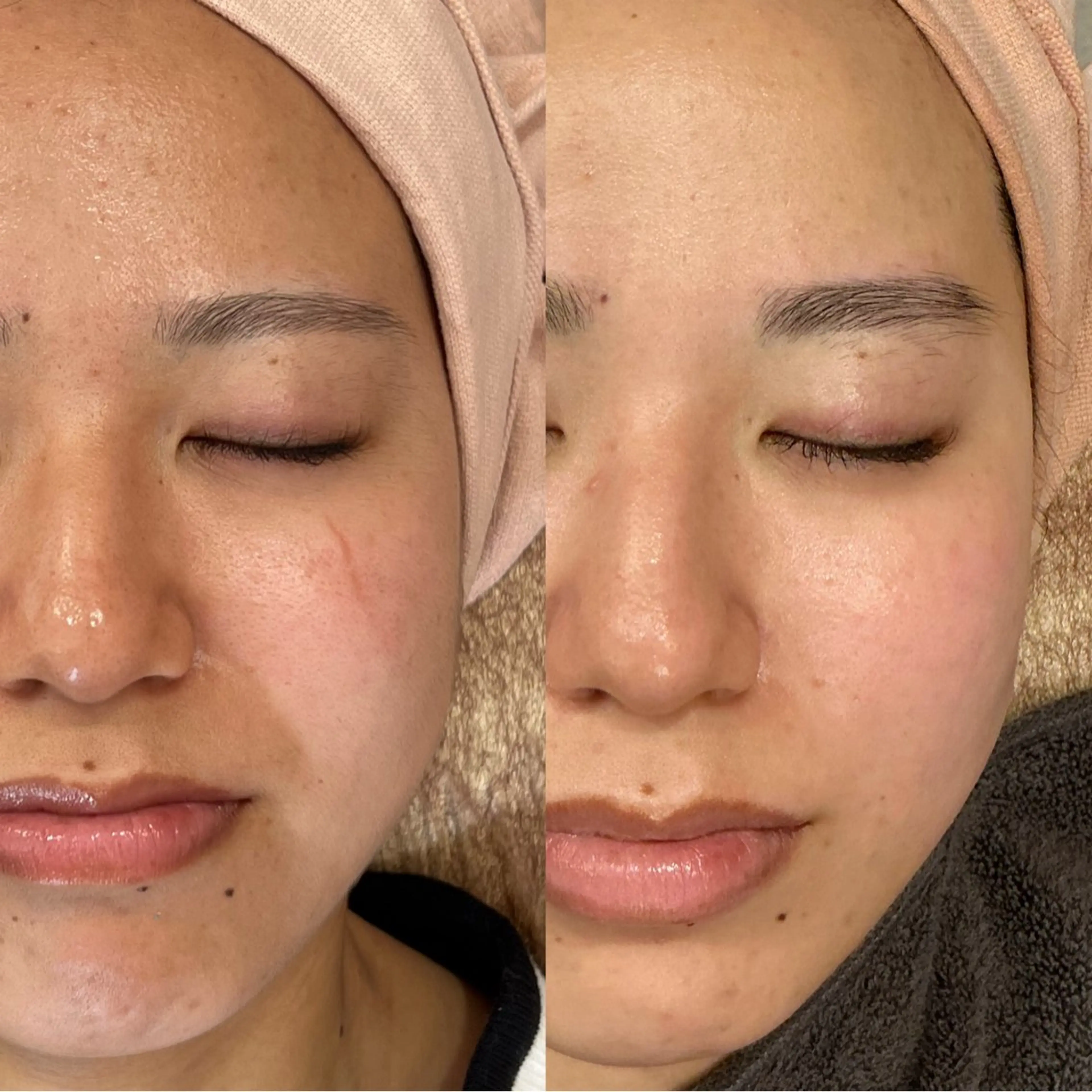 エステ lapis ueji所属・マツヤニ/岡崎エステ 子連れok/あやねのエステ・リラクイメージ