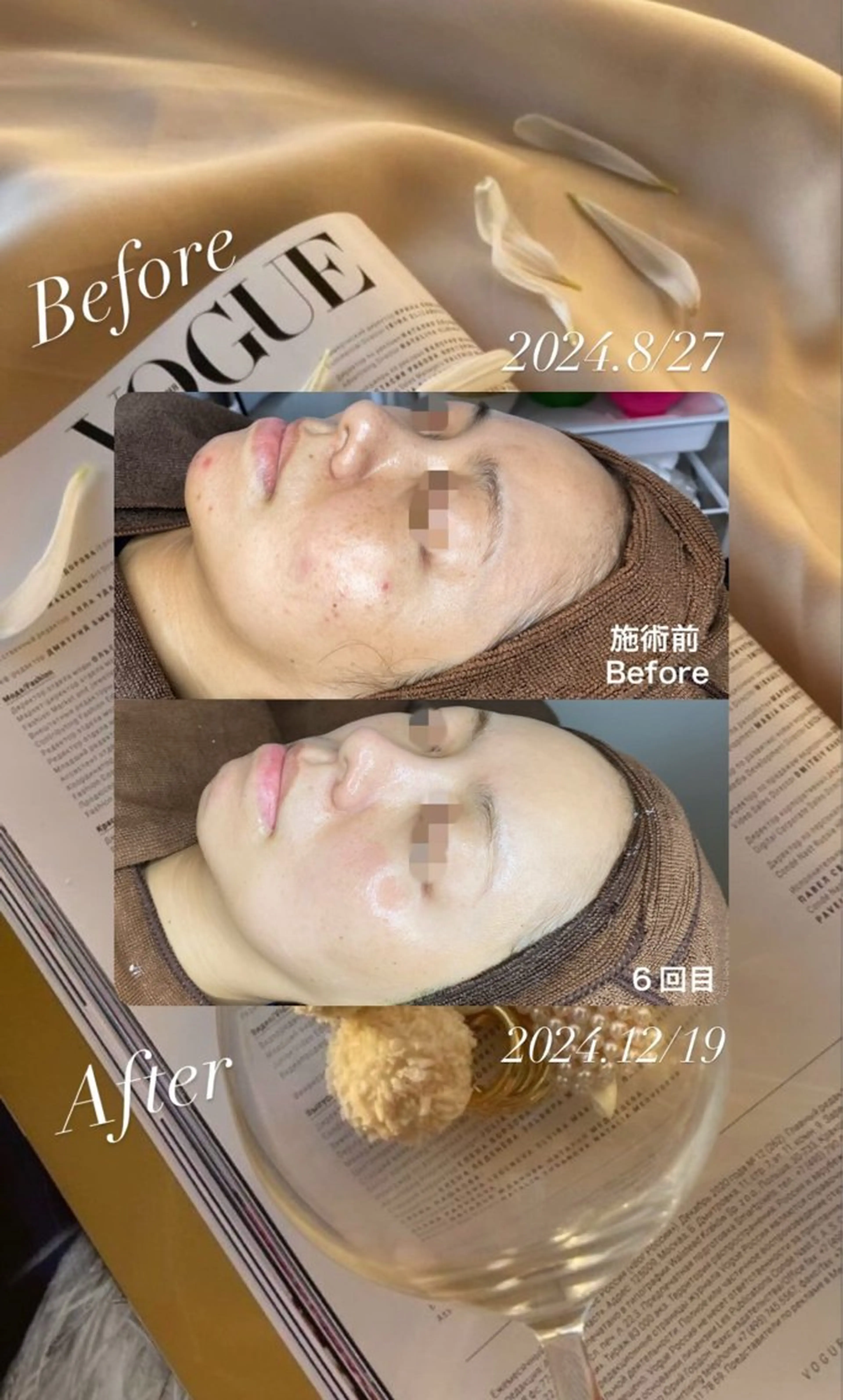 Lattina beautysalon所属・Lattina ラティーナのエステ・リラクイメージ