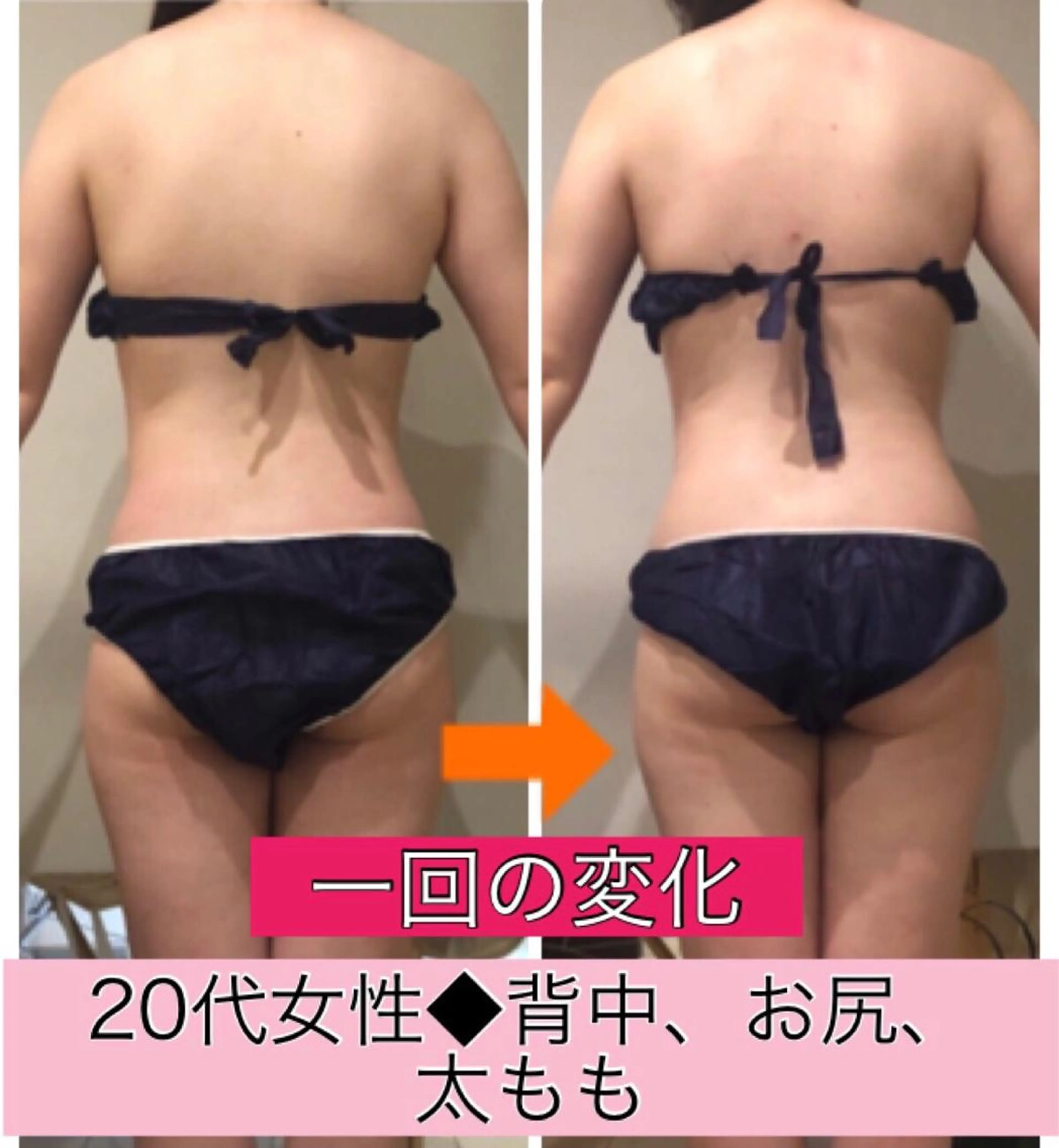 ロング カラー パーマ ヘアアレンジ メンズ キッズ ネイル マツエク・マツパ ‍痩身＆ボディ 結果出し🌟丹野のエステ・リラクイメージ