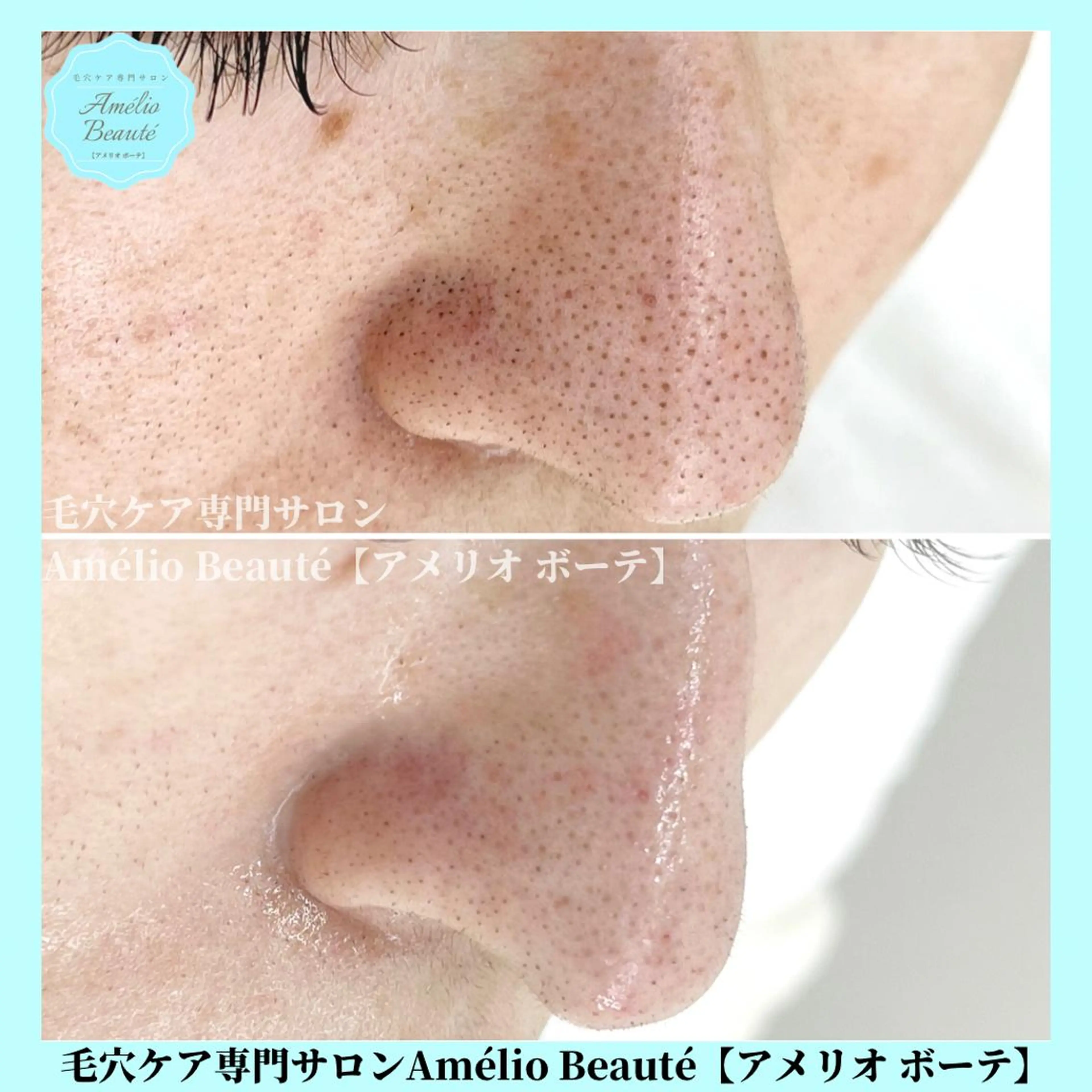 毛穴ケア専門サロン Amélio Beauté所属・毛穴ケア専門サロン アメリオボーテのその他イメージ