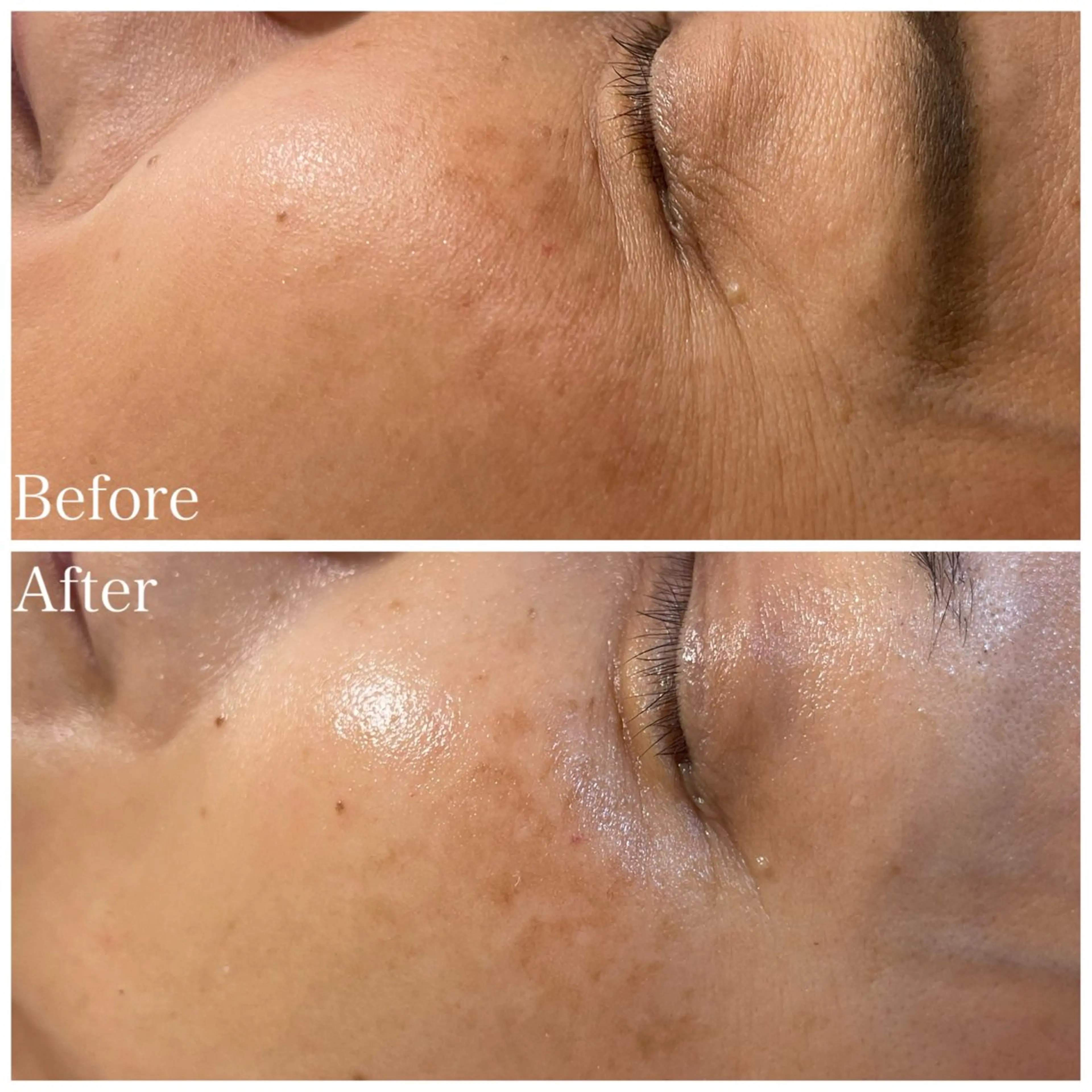 Nna Salon所属・Nna 韓国肌管理のエステ・リラクイメージ