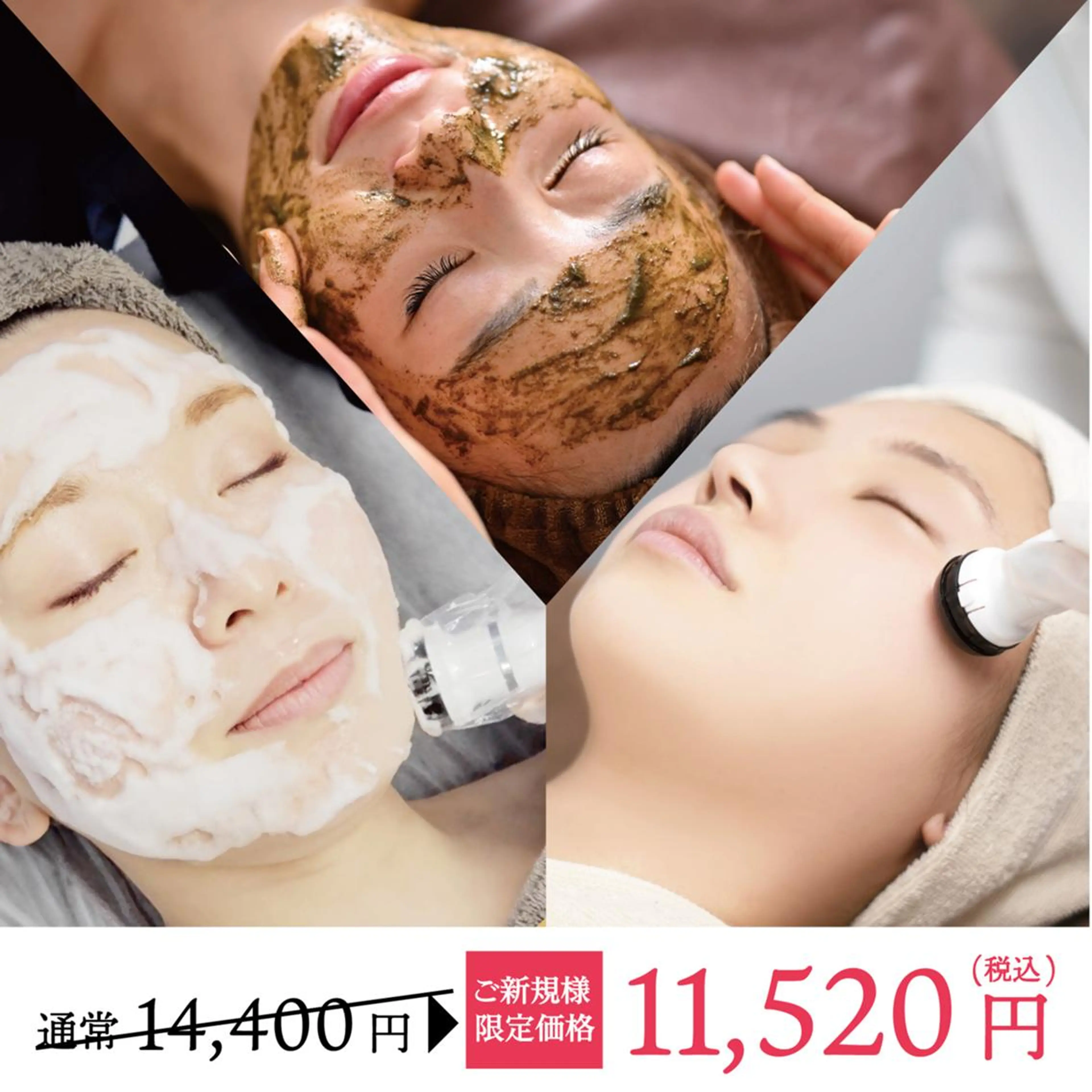 🫶🏻韓国陶器肌🫶🏻プラズマ＋ハーブピーリング＋炭酸パック🧼ヒアルロン酸付の写真