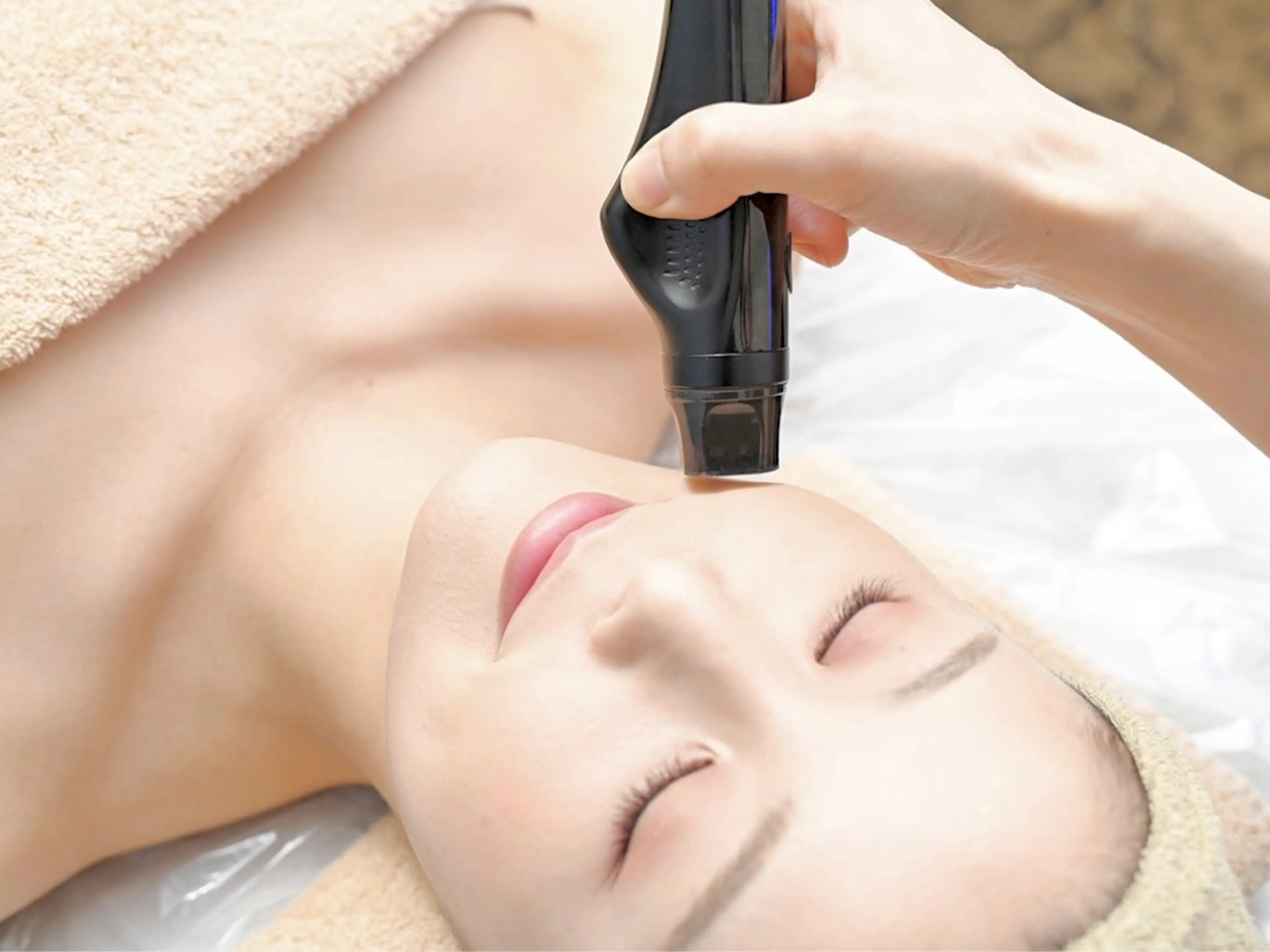 最新‼️≪切らないリフトアップマシン≫サーマルフラクショナル単品全顔200shot【小顔・たるみ・ほうれい線・しわ】の写真