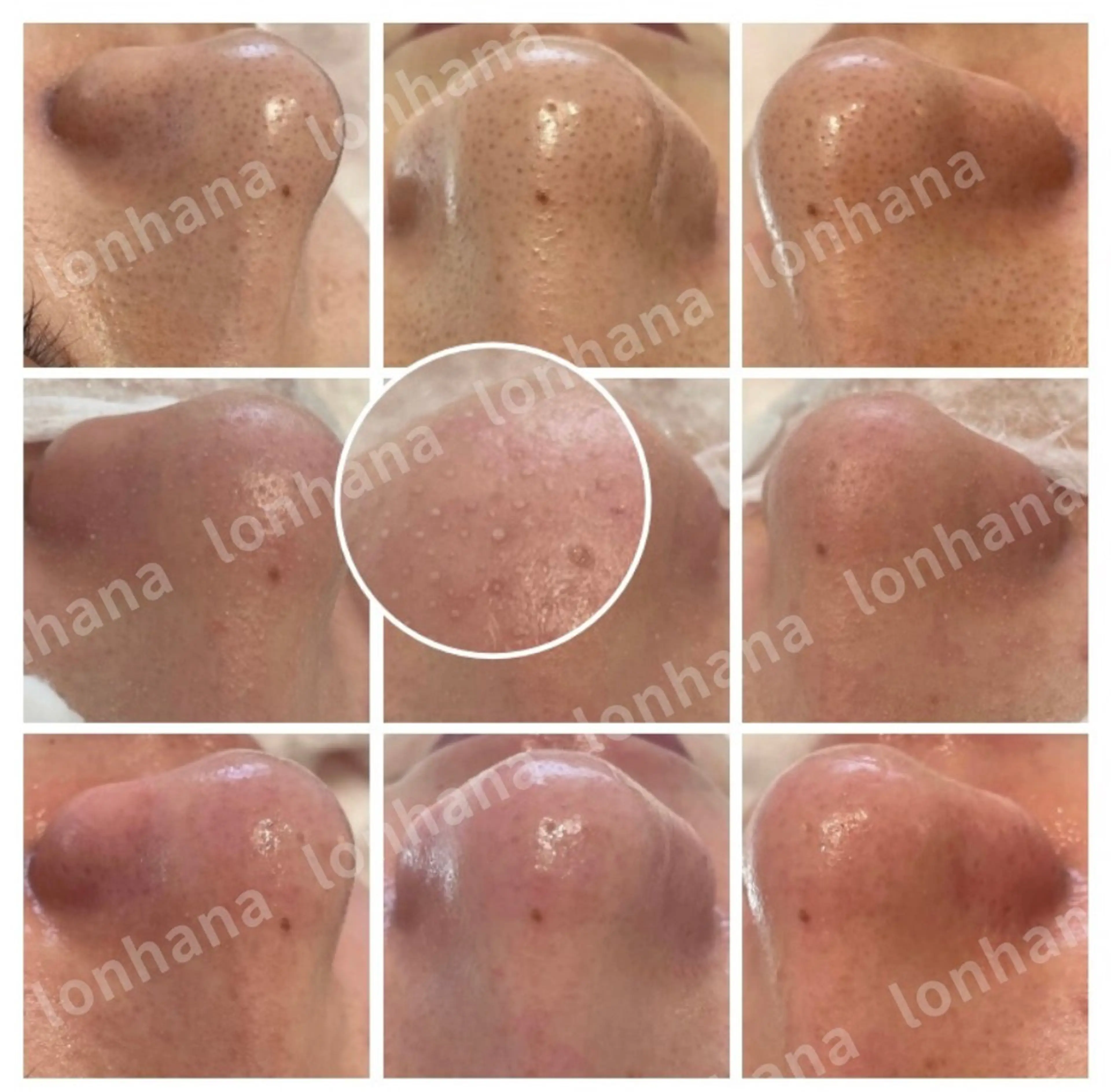 その他 ホワイトニング｜韓国式3D毛穴洗浄 lonhana ﾛﾝﾊﾅ所属・韓国式3D毛穴洗浄 lonhanaのその他イメージ