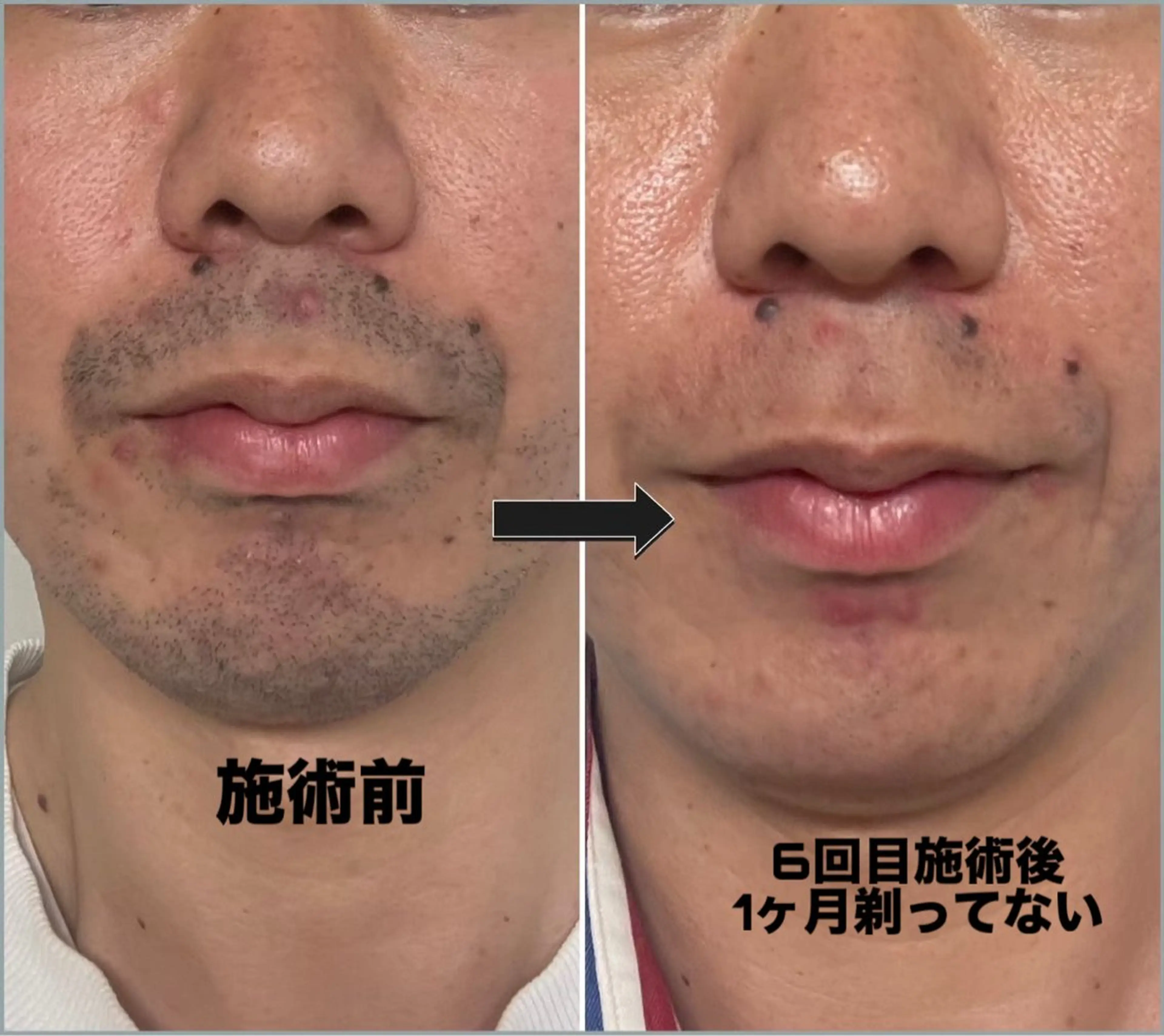 メンズ スリーエスプラス内　美肌サロンEme所属・希映 -kieのエステ・リラクイメージ