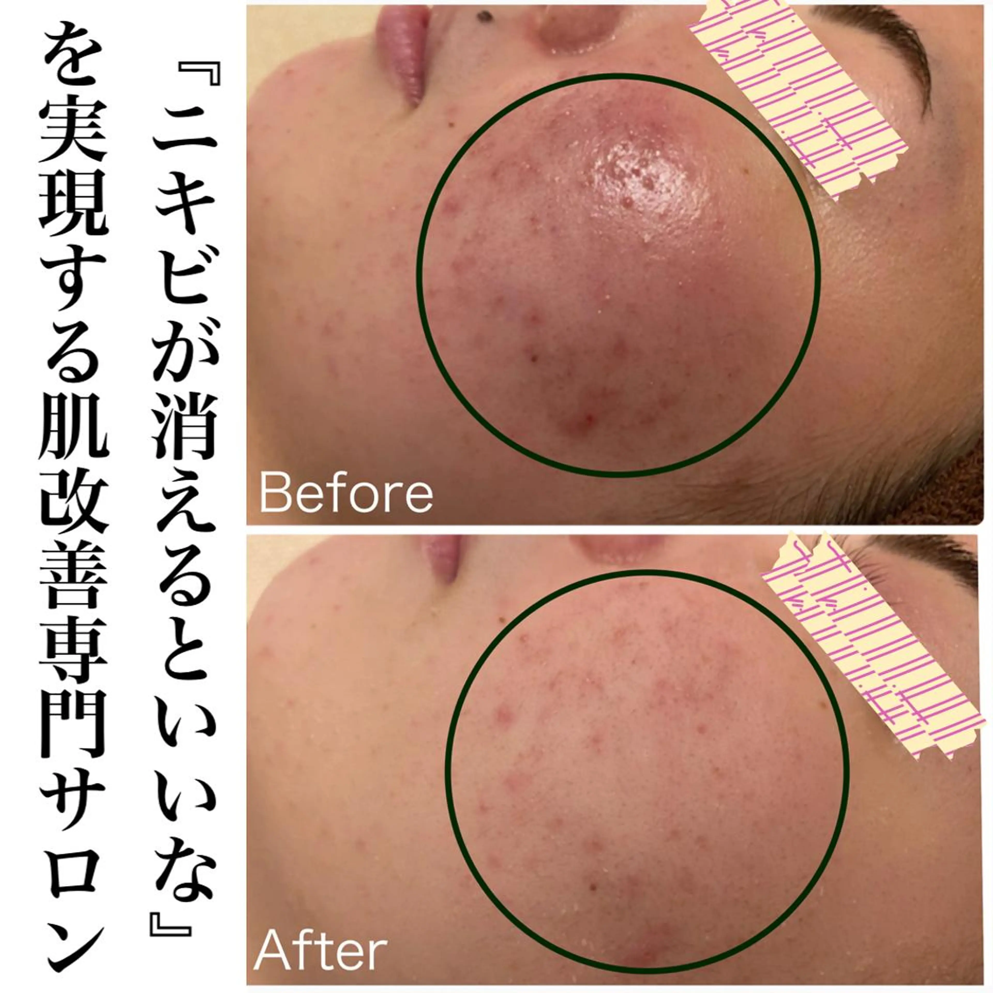 💌再来クーポン💌イオンピーリングで劇的変化！&温熱イオンパックでお肌が変わる🎶口コミ必須の写真