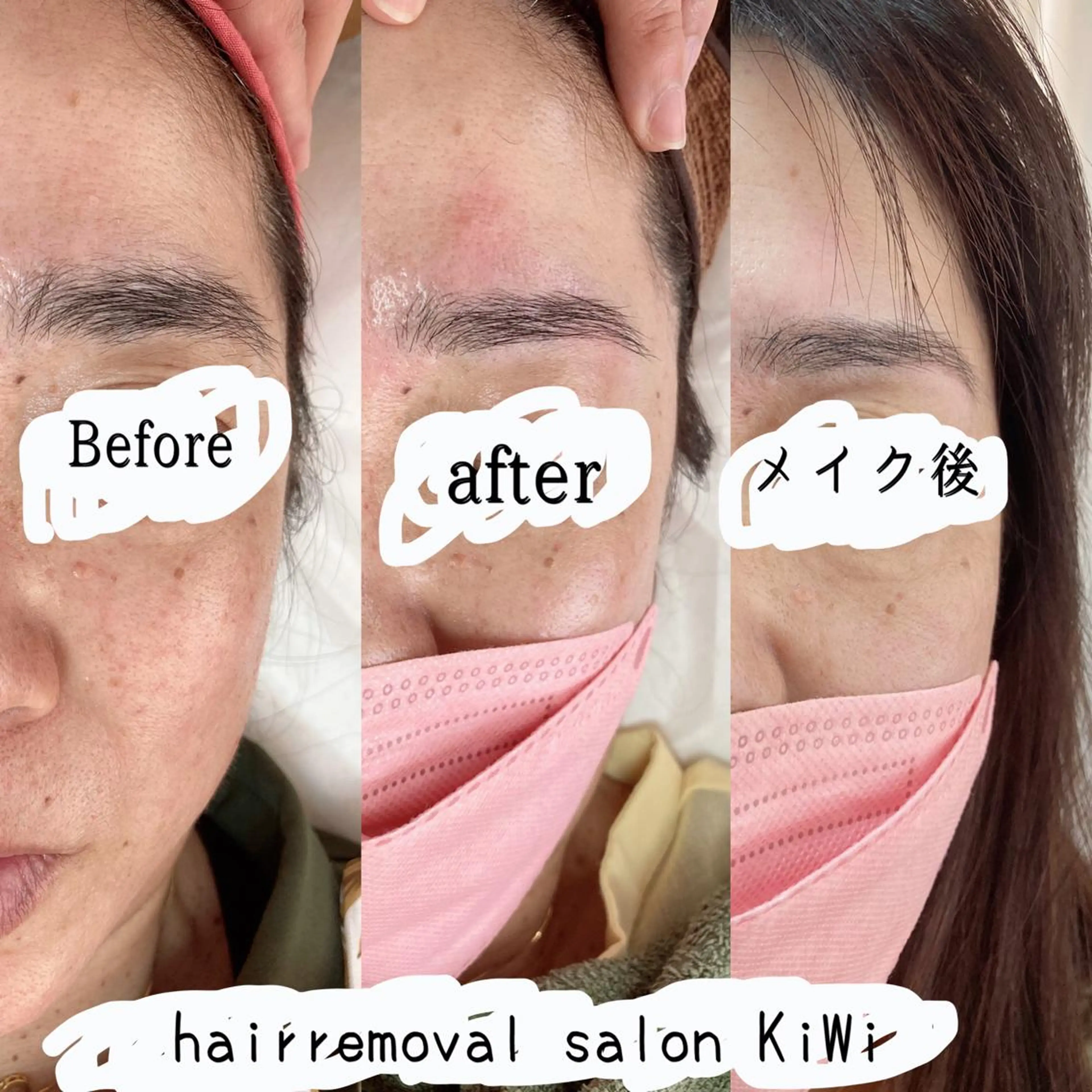 アイブロウ 脱毛サロン KiWiのエステ・リラクイメージ