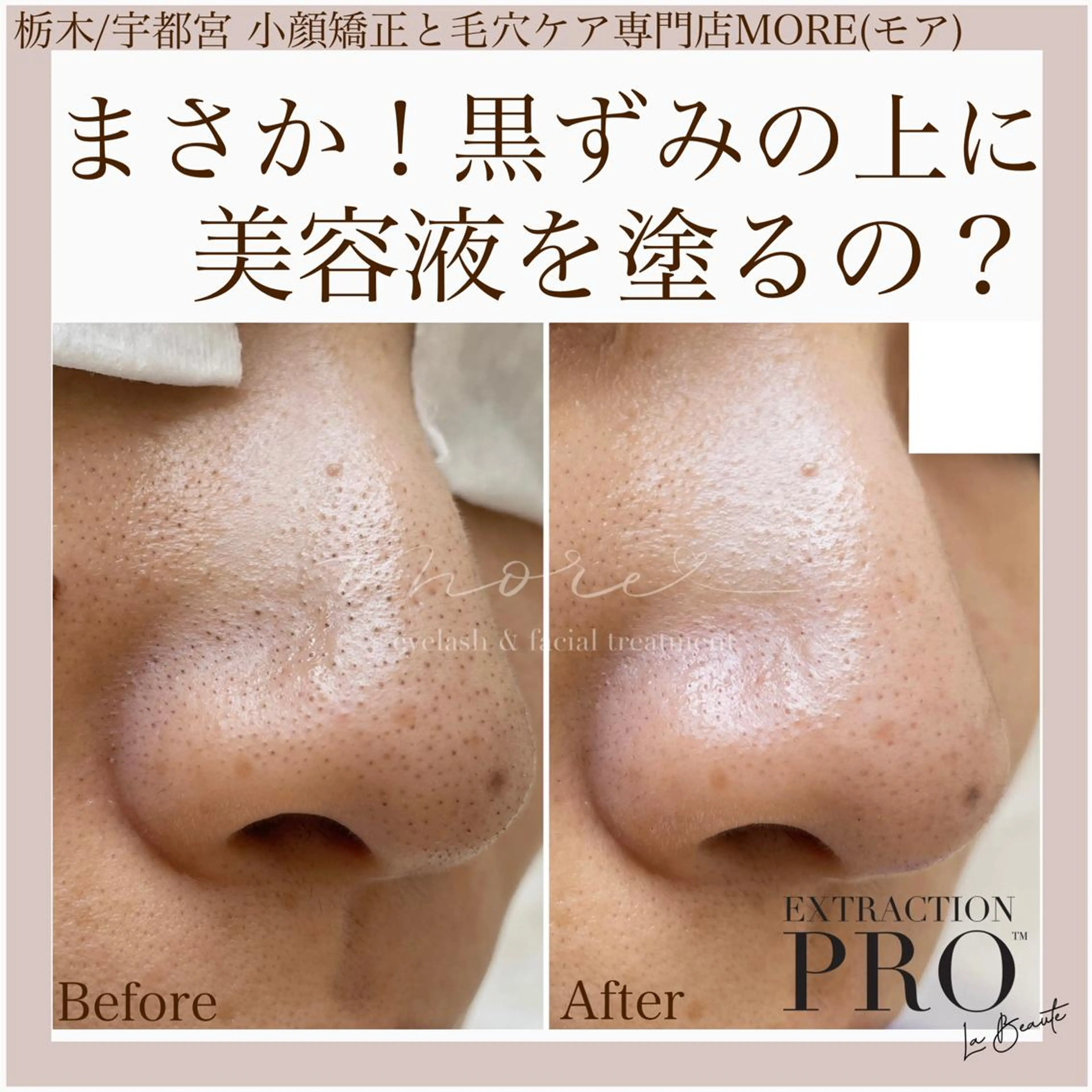 Eyelash salon MORE(モア)所属・安納 麻穂のエステ・リラクイメージ