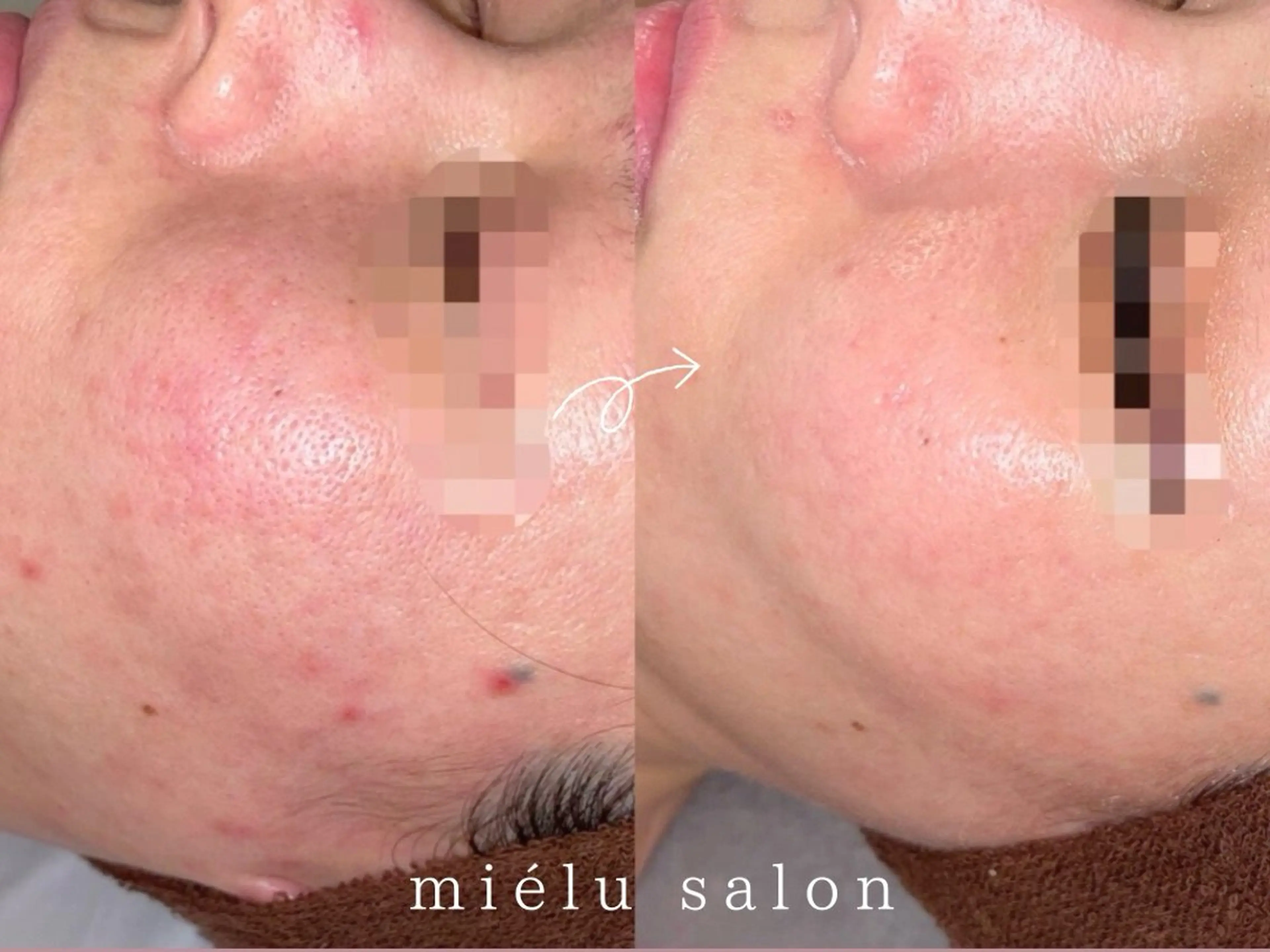 エステ リラク 小顔|痩身salon miélu ミエルのエステ・リラクイメージ