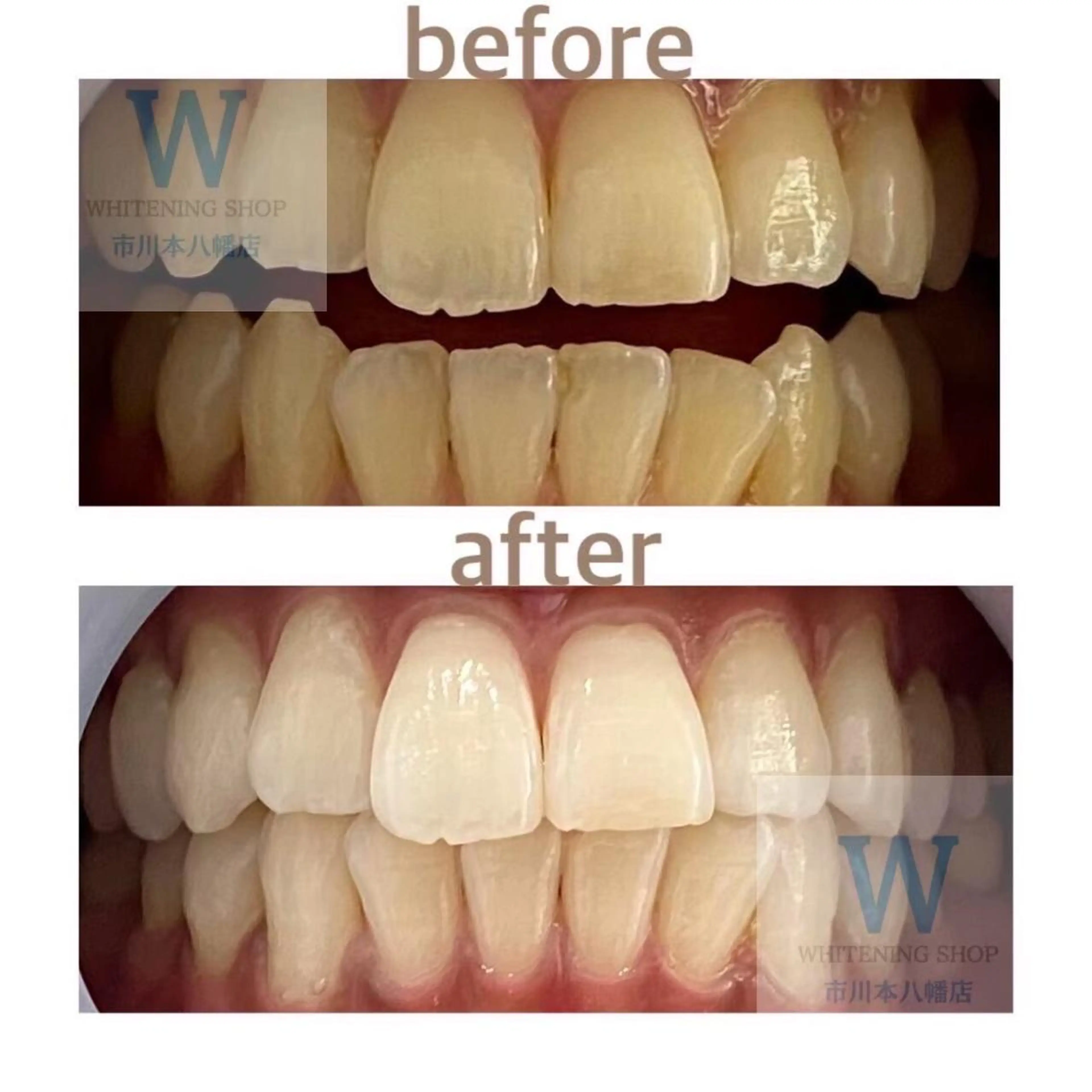 ホワイトニング ショップ本八幡店のエステ・リラクイメージ