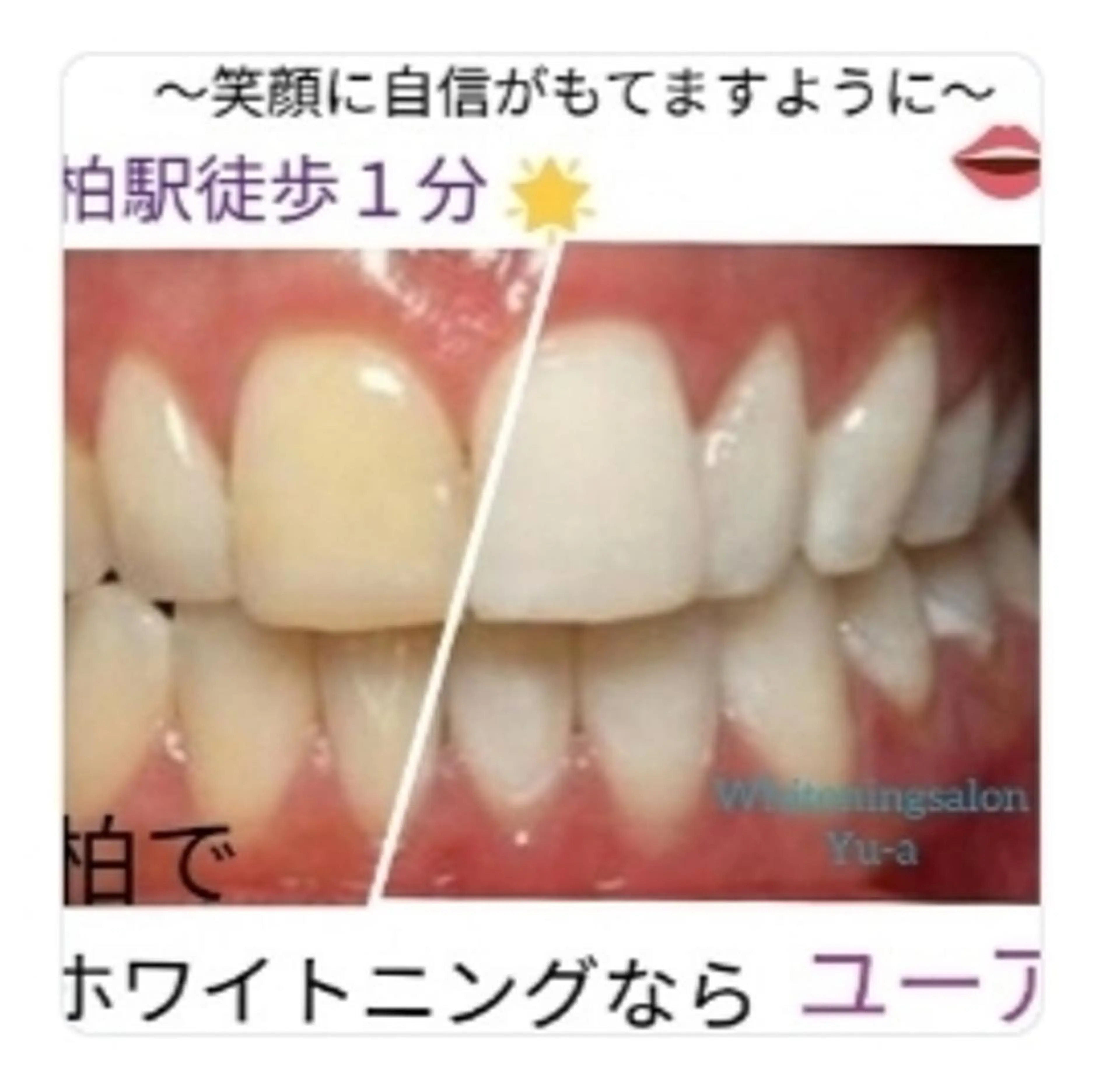 yu-a☆  ネイル ＆ホワイトニングのネイルデザイン