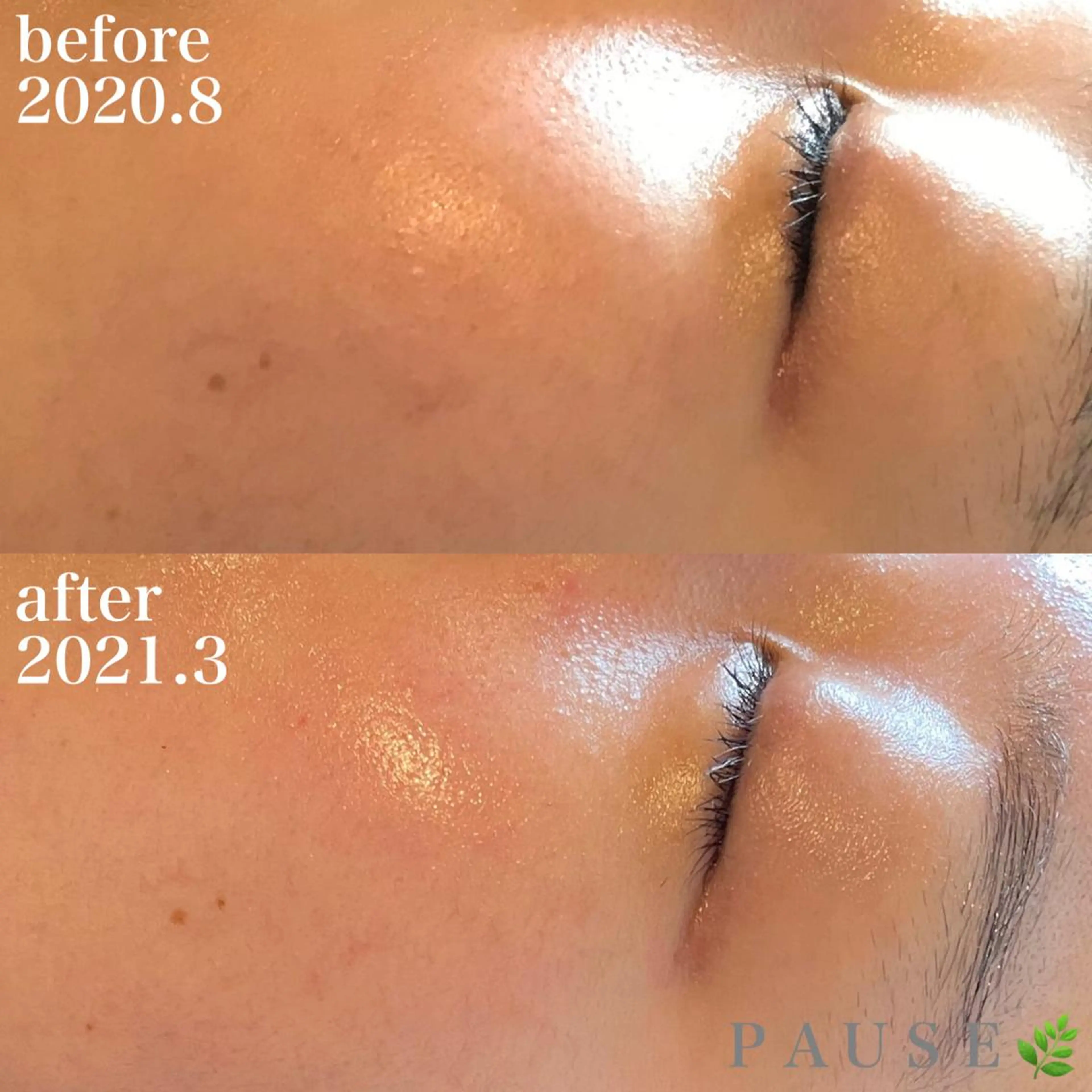 エステ 浜野 恵美のエステ・リラクイメージ