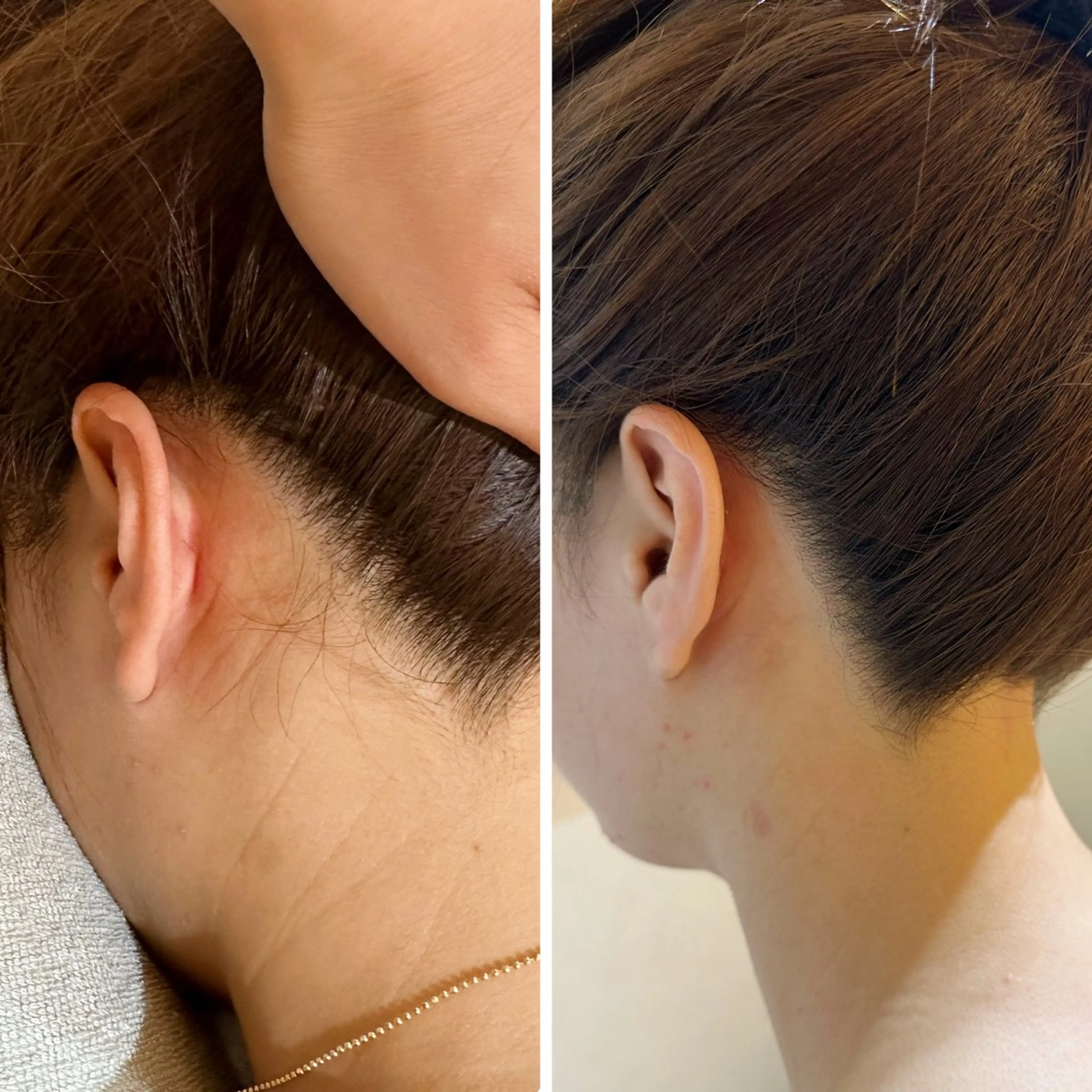 うなじ脱毛/美肌脱毛 LABELのエステ・リラクイメージ