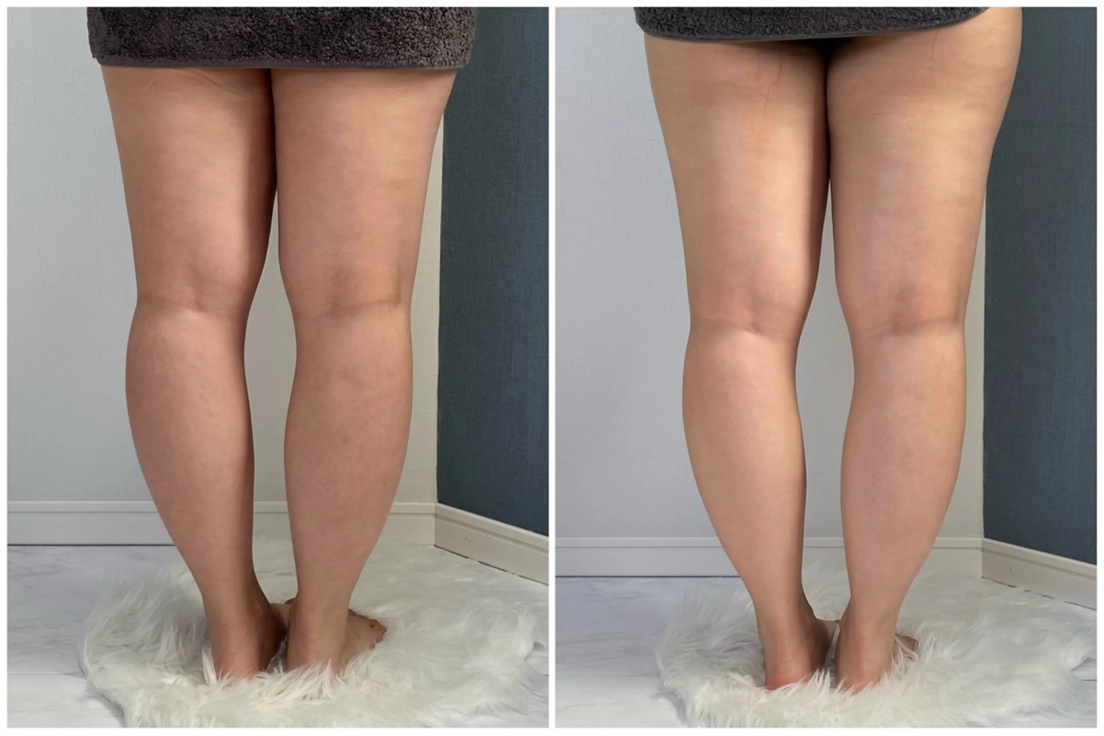 湘南エステサロン moaのエステ・リラクイメージ