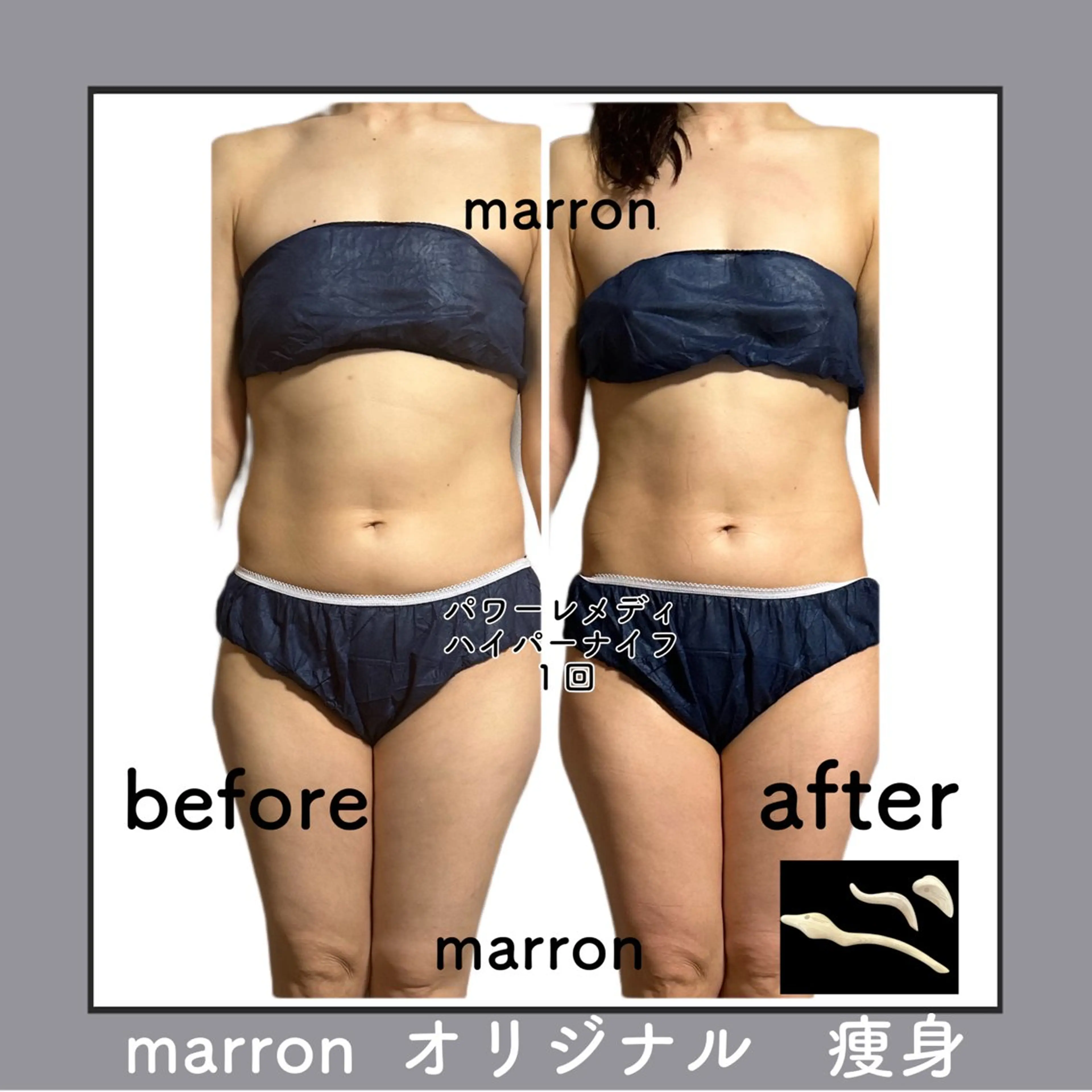 marron所属・痩身ハイパーナイフ ララピールリアボーテのエステ・リラクイメージ