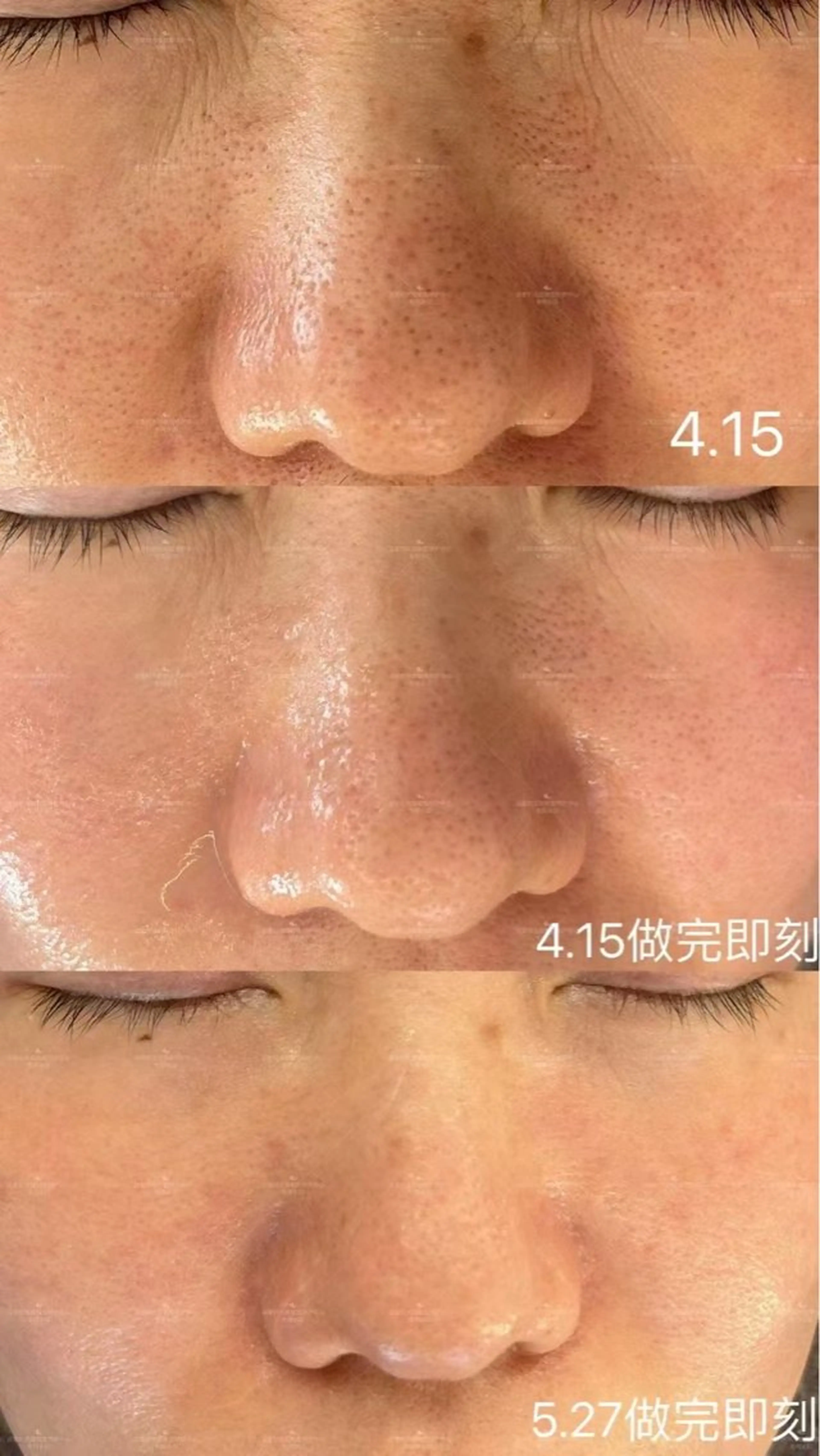 ショート エステ aliaハイフ&水光ジェットサロン所属・aliaハーブ水光店 エステティシャン募集のエステ・リラクイメージ