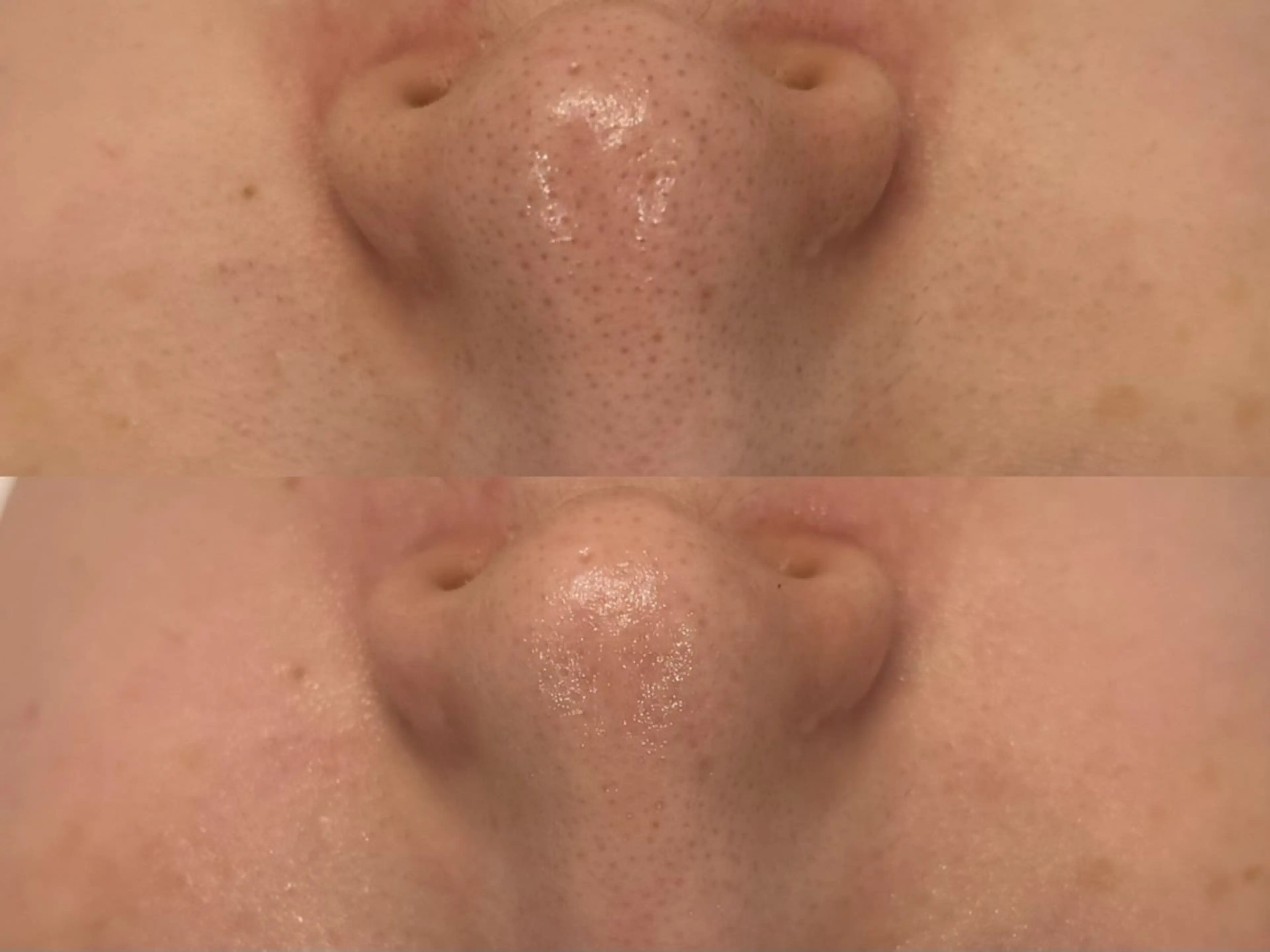 べアール所属・小顔/毛穴/ニキビ salon bealのエステ・リラクイメージ