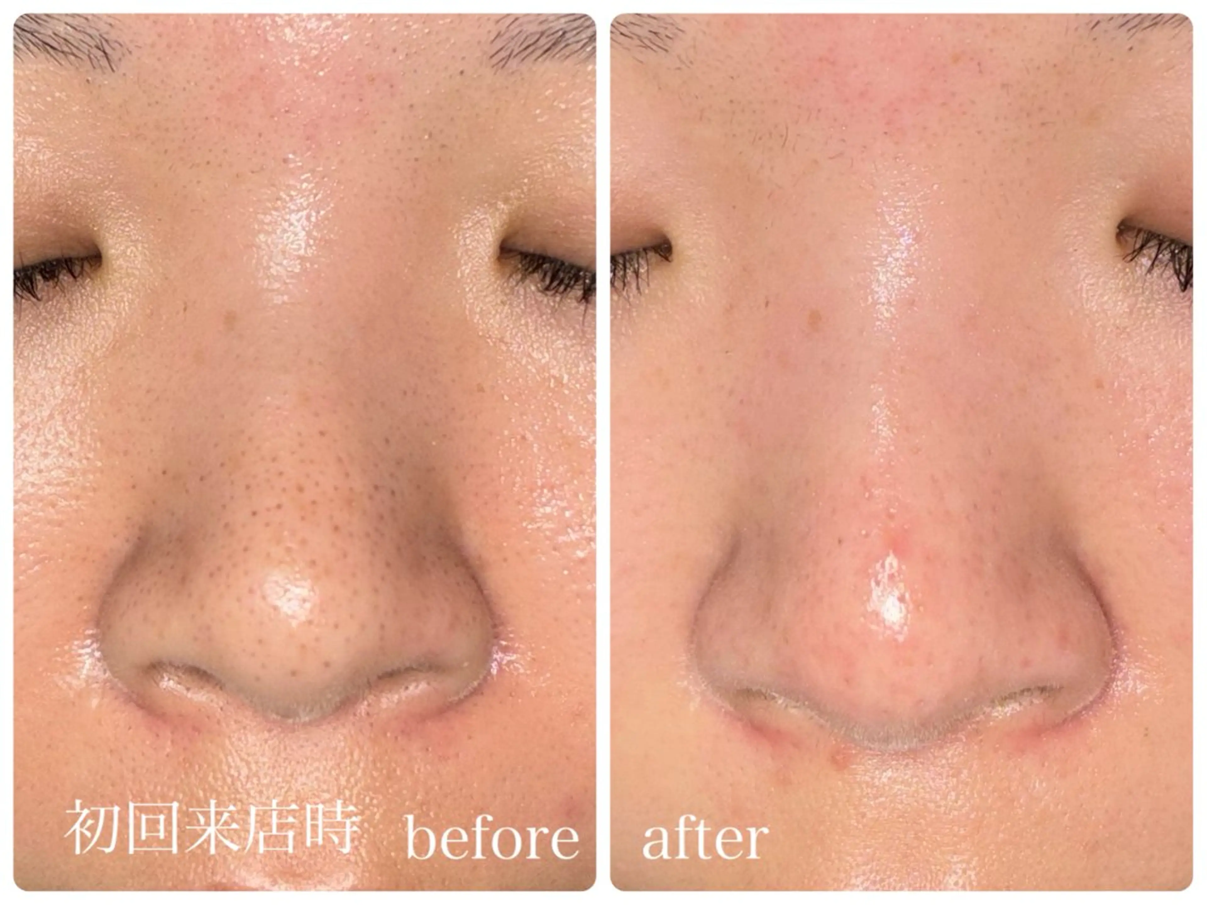 salonＮ所属・24時間営業 ハーブ/毛穴洗浄のエステ・リラクイメージ