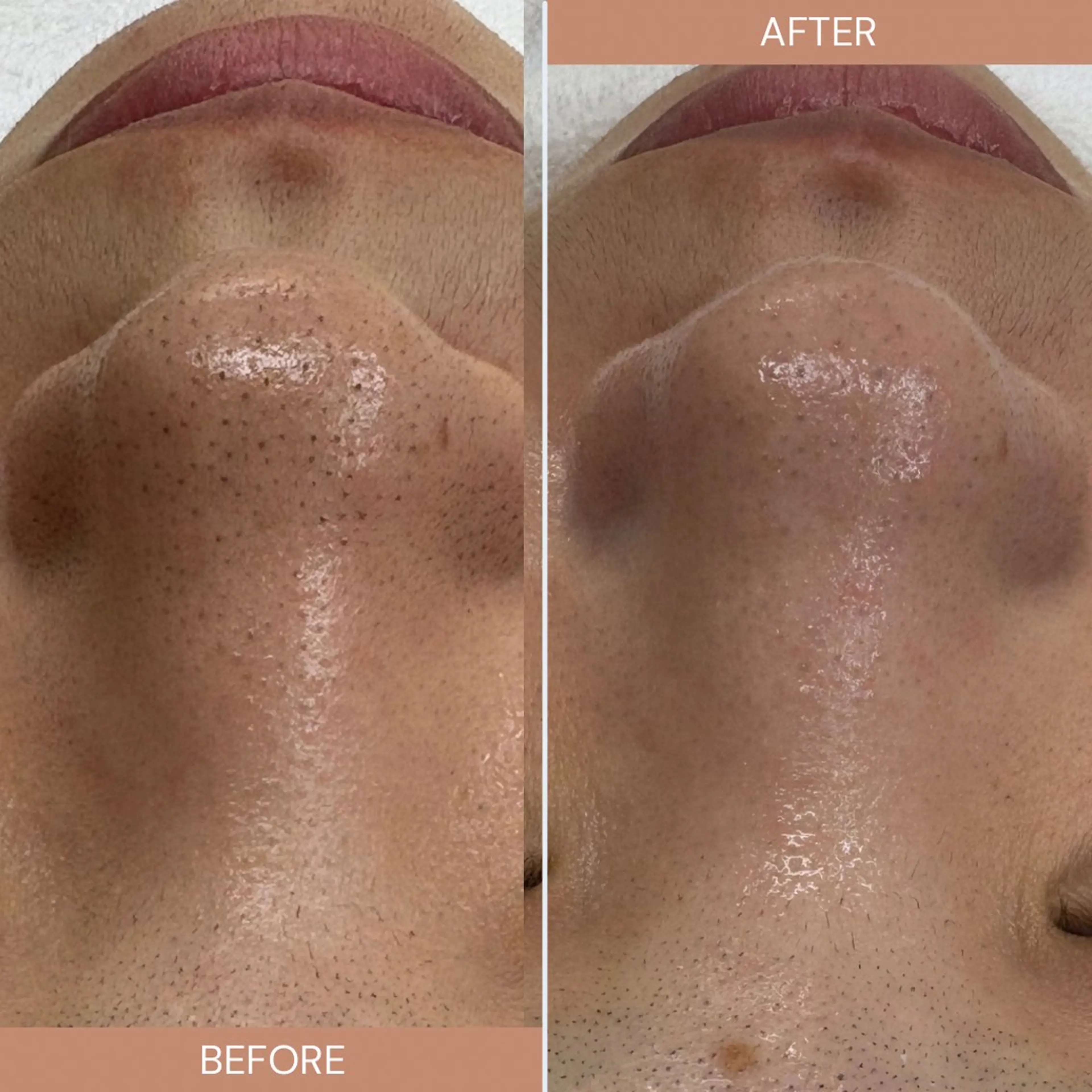 その他 フェイシャルサロン クリスタのエステ・リラクイメージ