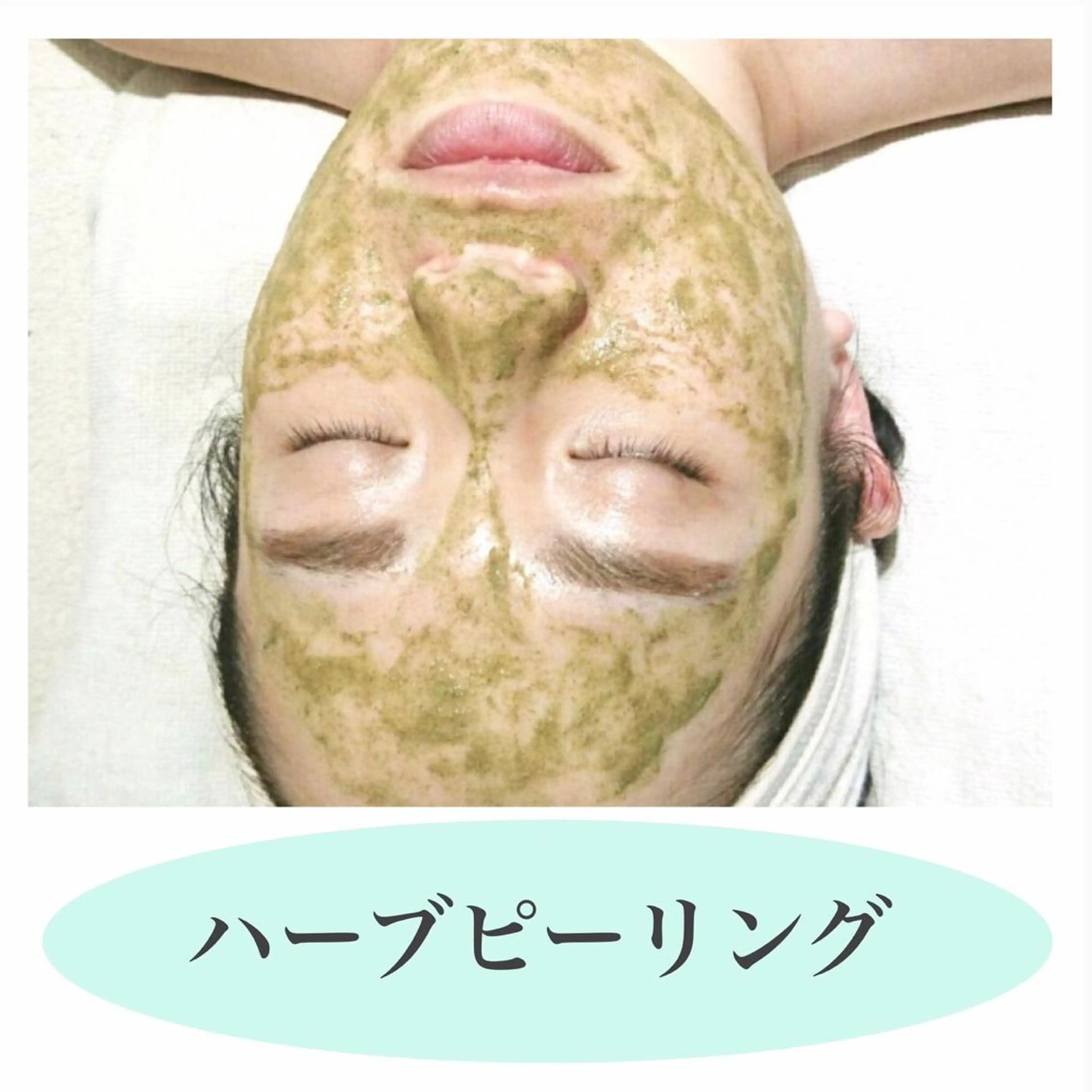 🟡8月の平日ご来店限定激安クーポン🟡ハーブピーリング🌿陶器肌/悩みゼロ美肌に！の写真