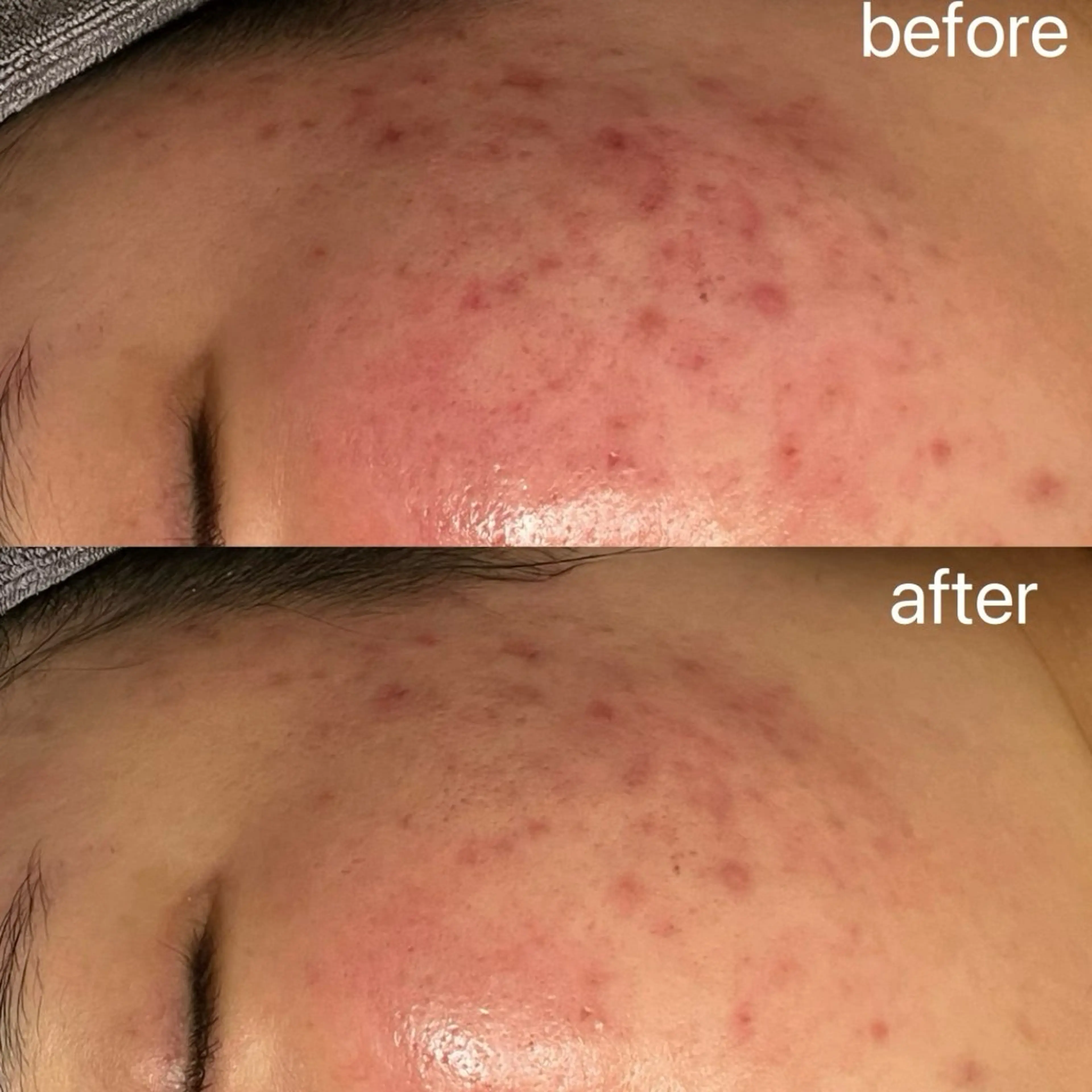 エステ 小顔＆まつ毛サロン AKANE❤️のエステ・リラクイメージ