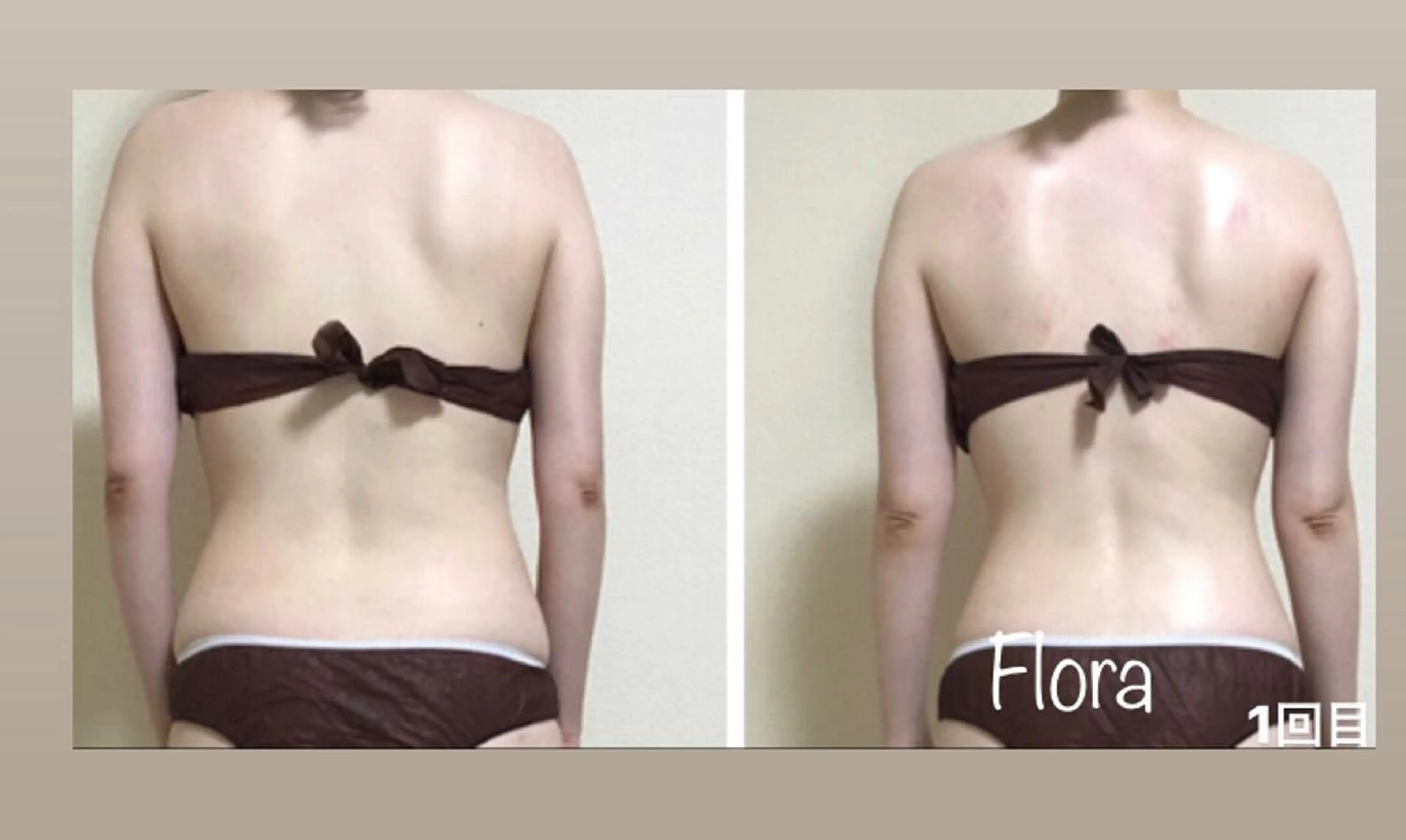 温活痩身エステ Floraのエステ・リラクイメージ