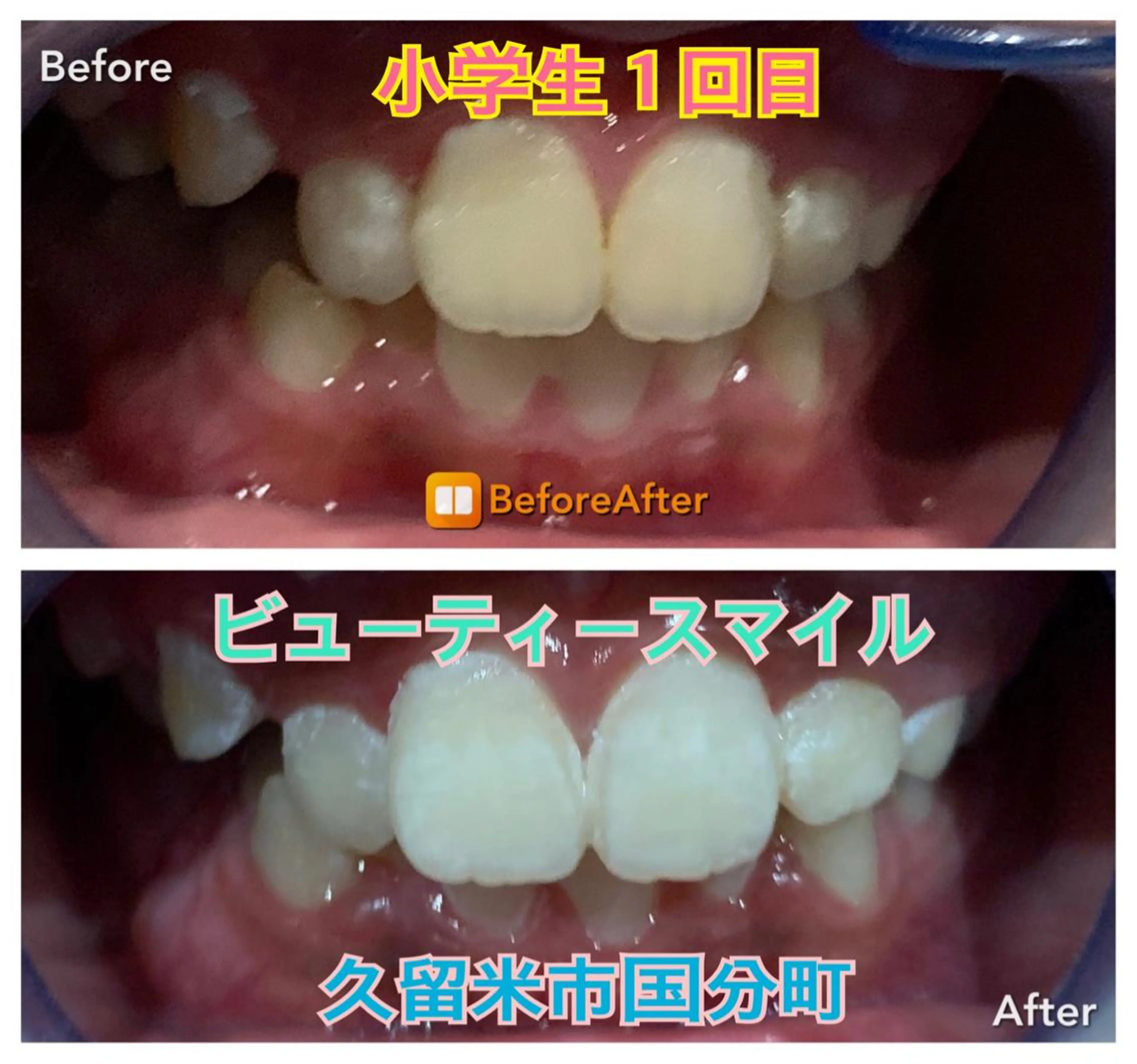 メンズ キッズ 学生（メンズ向け） AILINDA  BEAUTY所属・アイリンダ ビューティーのエステ・リラクイメージ