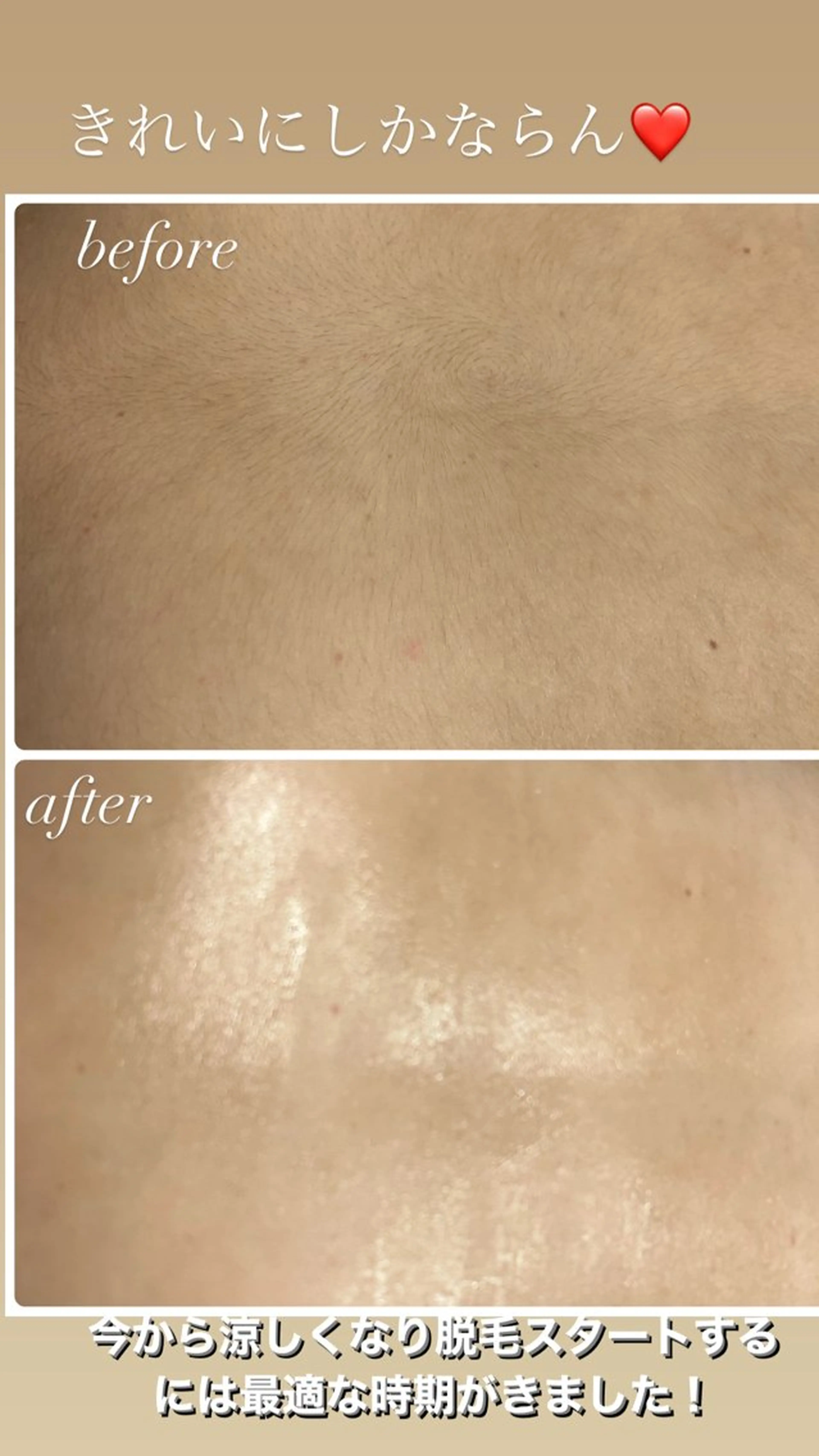 美肌脱毛fuu okinawa所属・宜野湾美肌脱毛fuu okinawaタイラのエステ・リラクイメージ