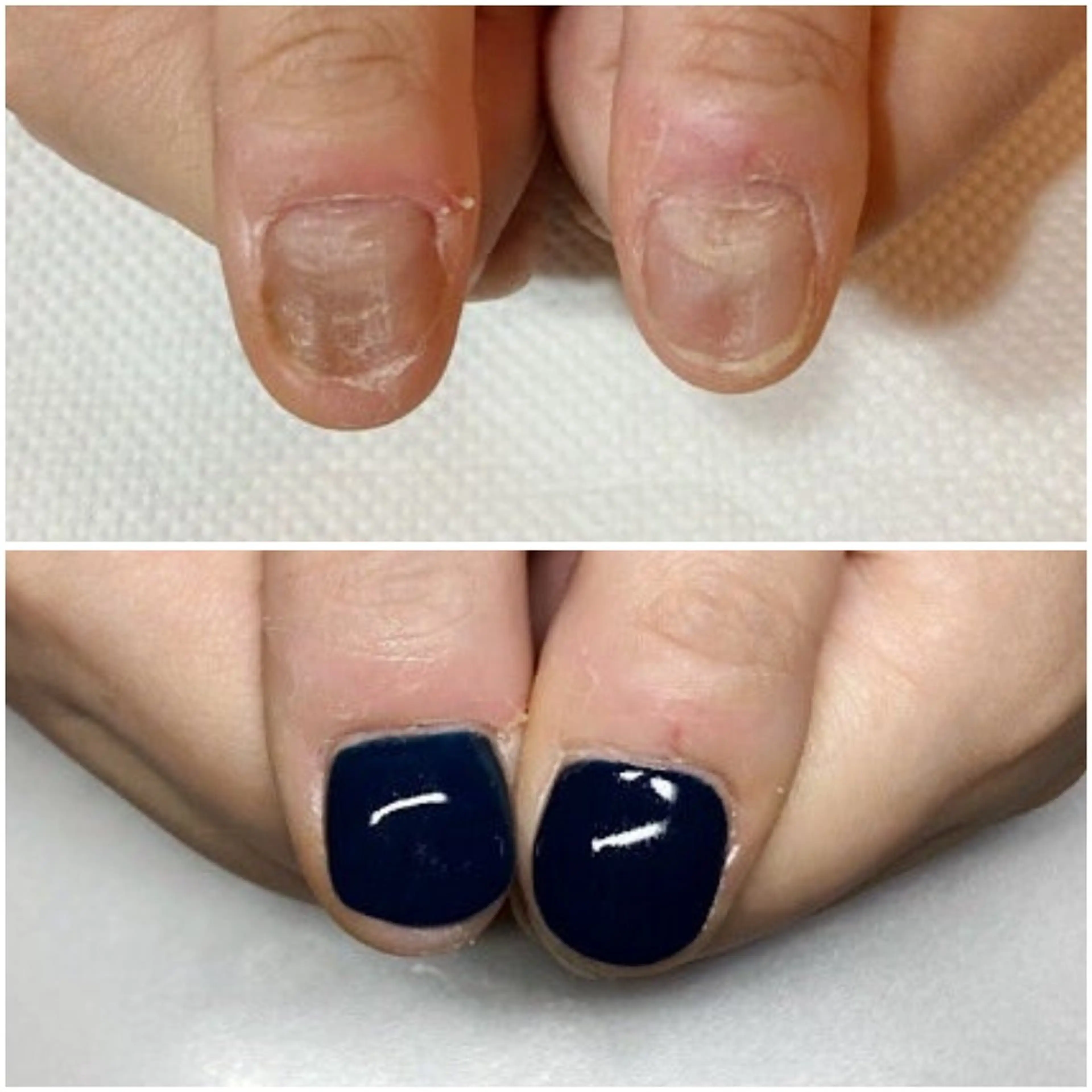 ネイル ネイルサロンアリューム所属・ネイルサロン アリュームのネイルデザイン