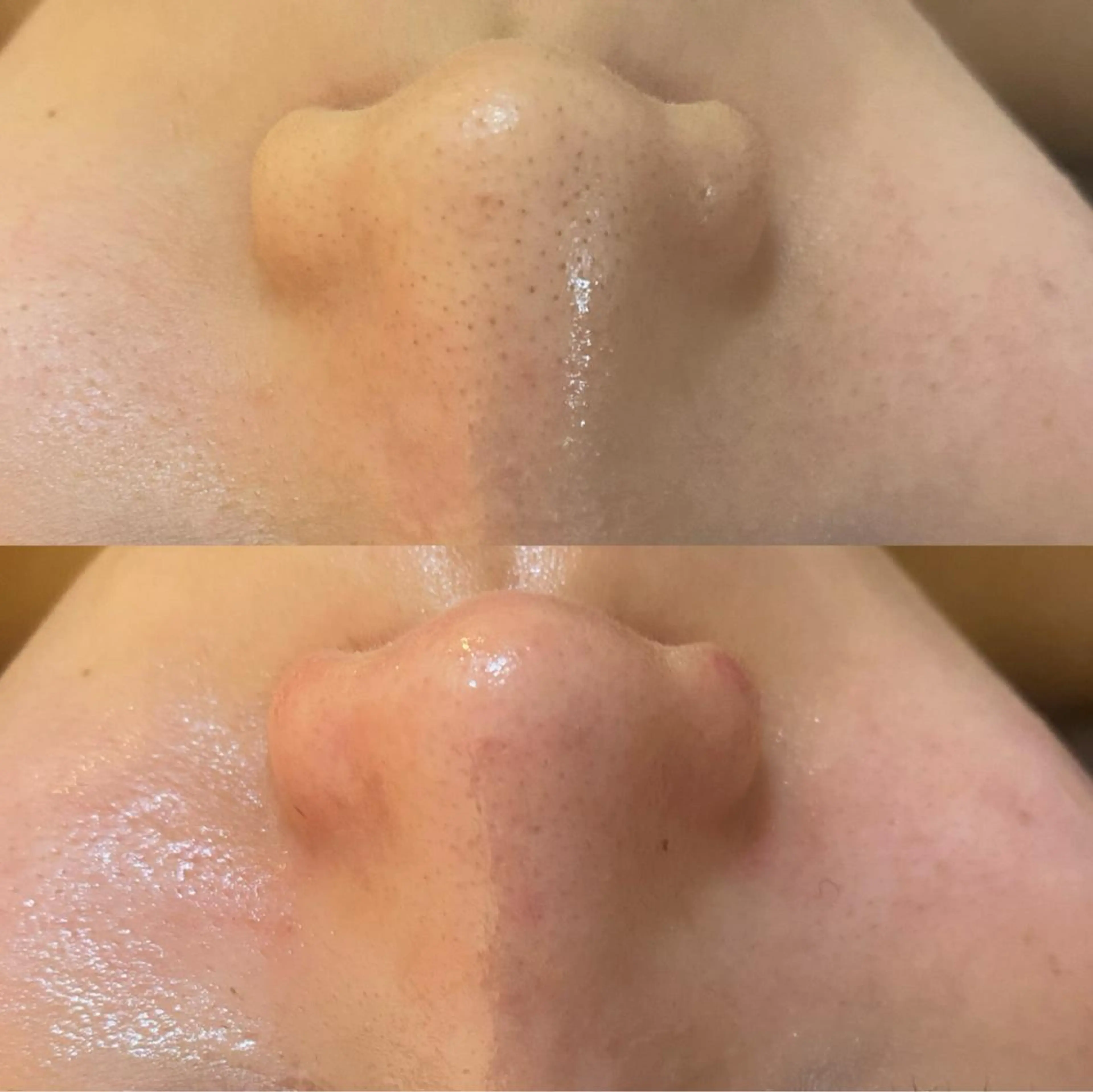 エステ リラク BELCIA福岡店　récolte de BELCIA（レコルトデベルシア）所属・BELCIA福岡店 レコルトデベルシアのエステ・リラクイメージ