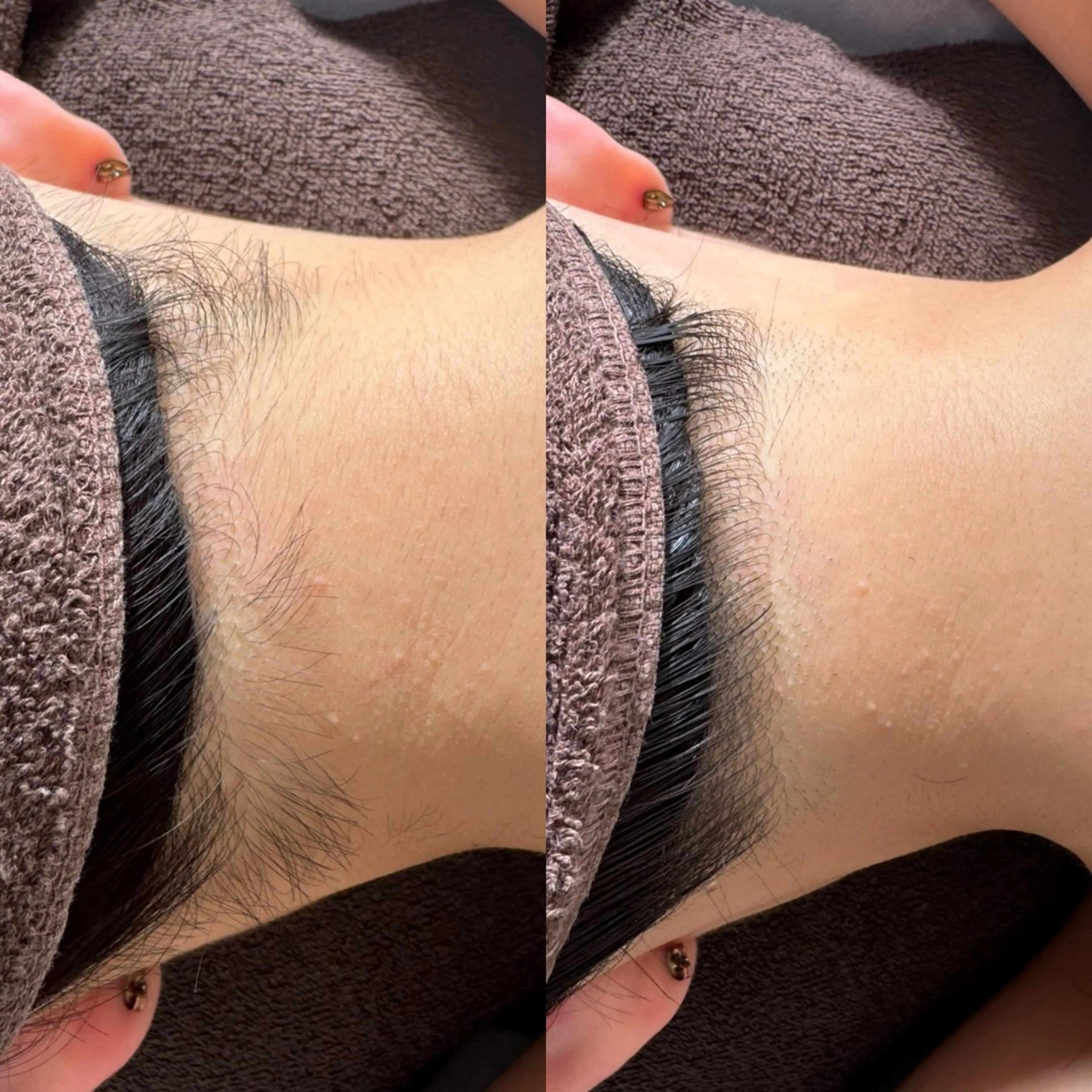 脱毛 salonvilla所属・villa ☺︎草山 楓花のエステ・リラクイメージ