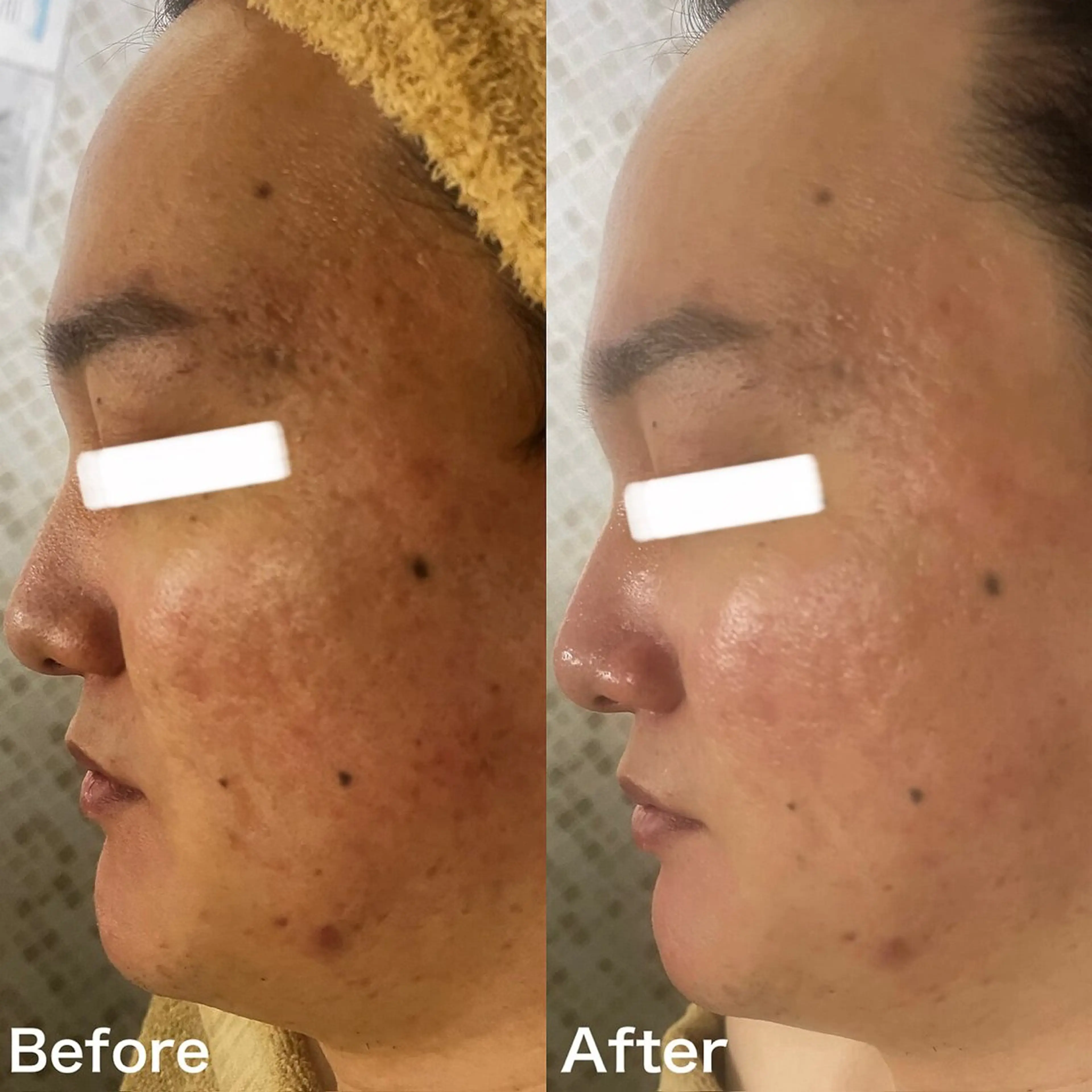 小顔&美肌品川店 Masqueradeのエステ・リラクイメージ