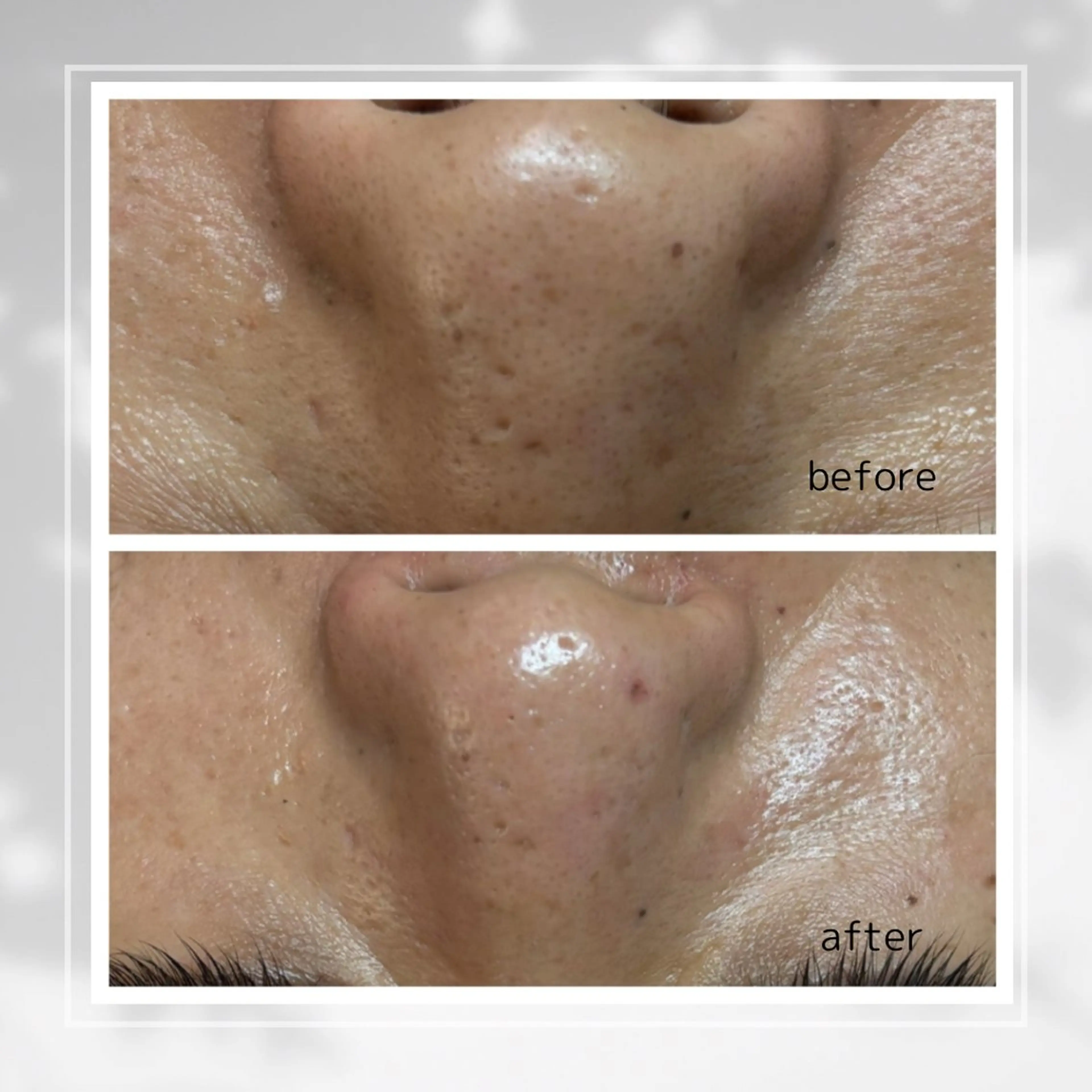 エステ 肌質改善フェイシャルCLEAR栄生/リンパ/毛穴/シミケア所属・井戸 麻衣のエステ・リラクイメージ