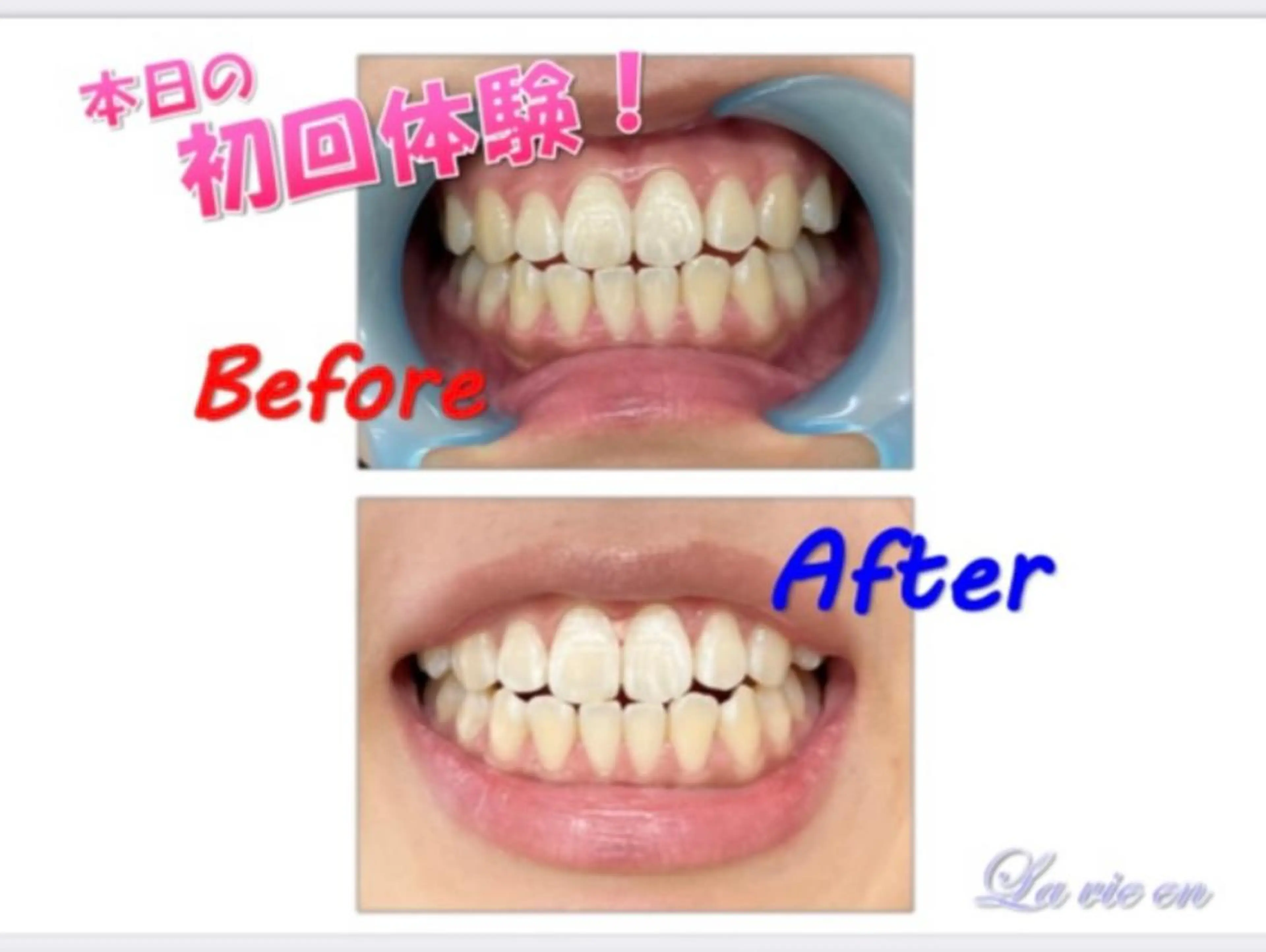 その他 セルフホワイトニングサロン　ラヴィアン所属・ホワイトニングサロン La vie enのその他イメージ