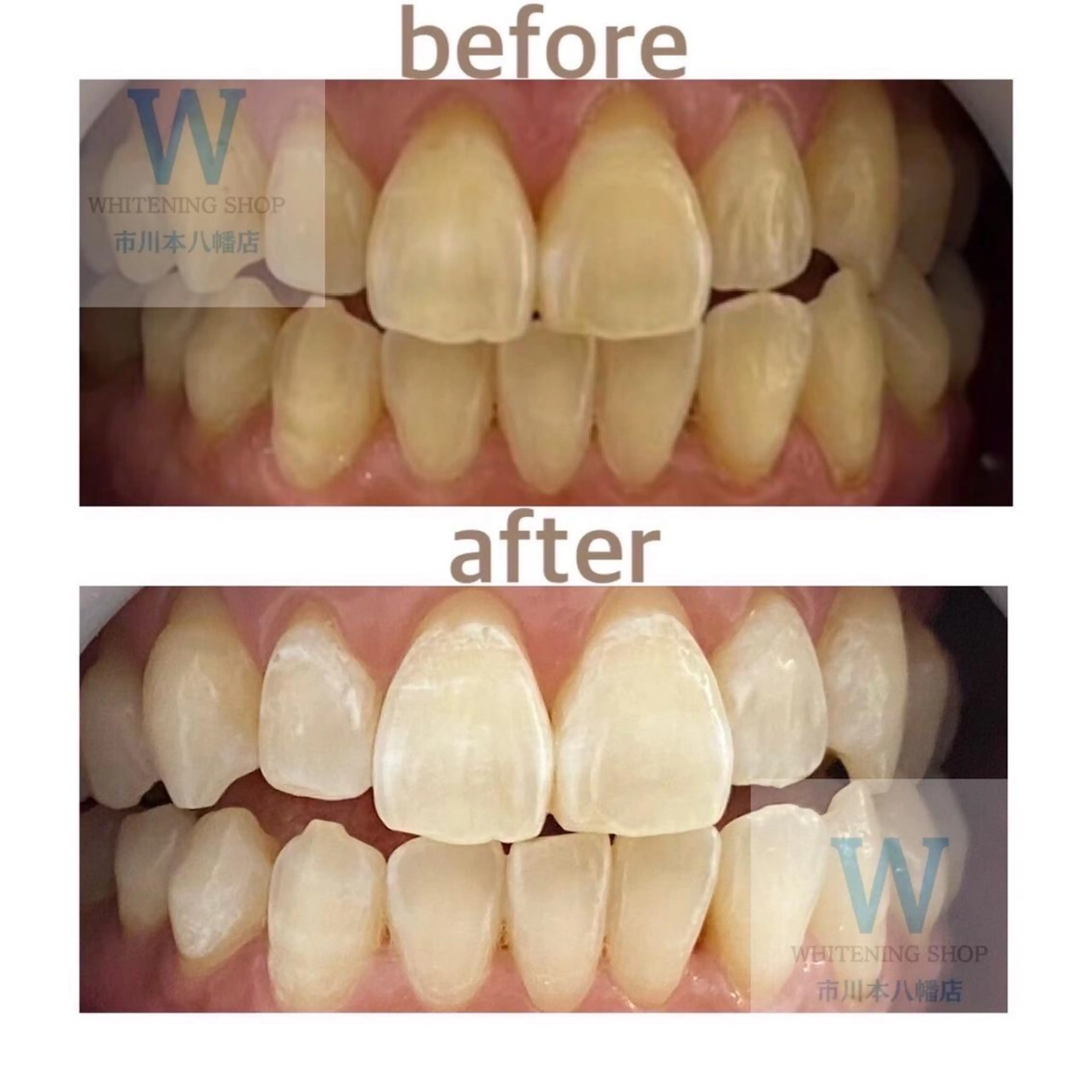 ホワイトニング ショップ本八幡店のエステ・リラクイメージ