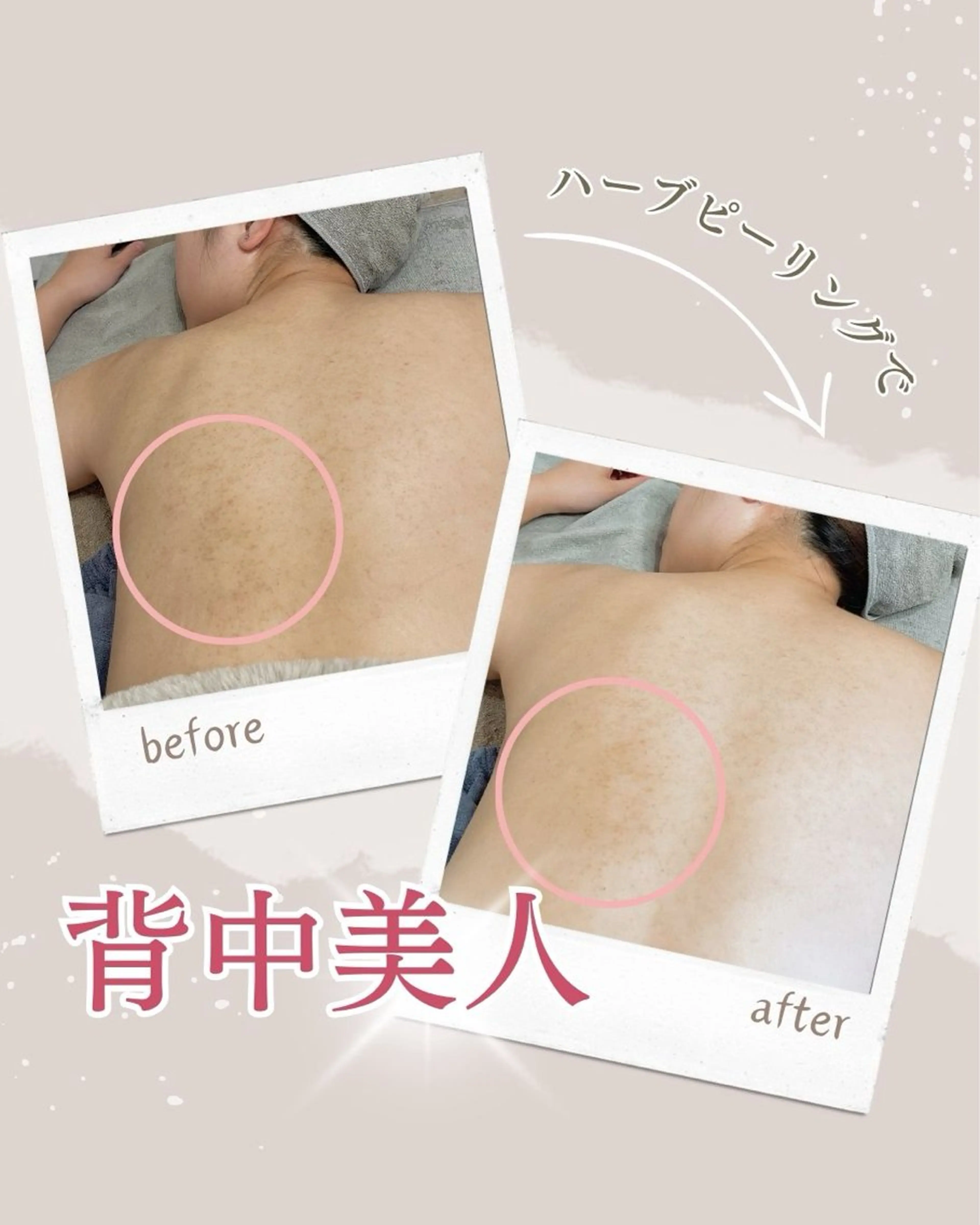 エステ Lupure(ルプレ)所属・美肌サロン💎ハーブ ピーリング🌿ルプレのエステ・リラクイメージ