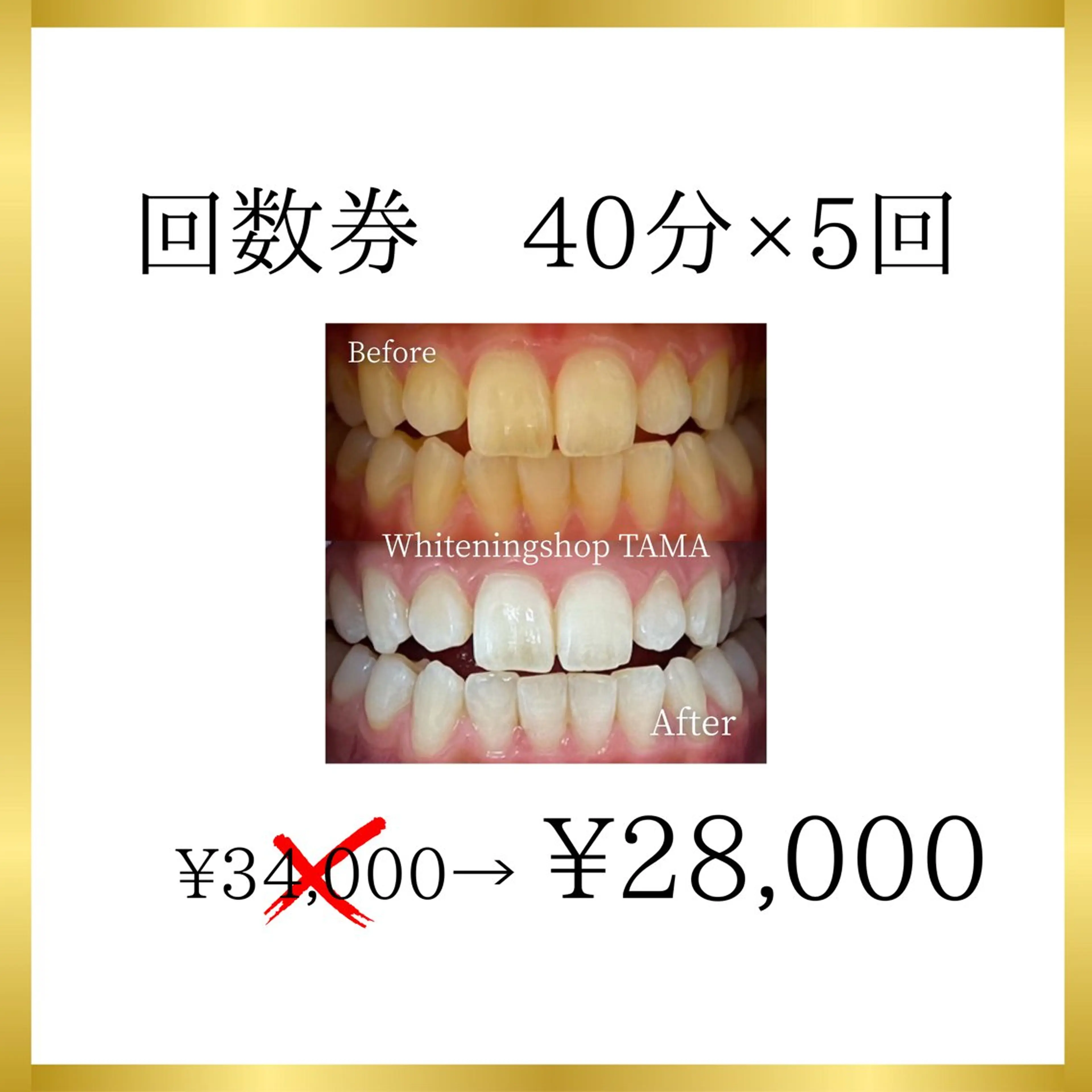 ミニモ限定【まずは少し通ってみたい方♪】回数券40分×5回（5来店）¥28,000の写真