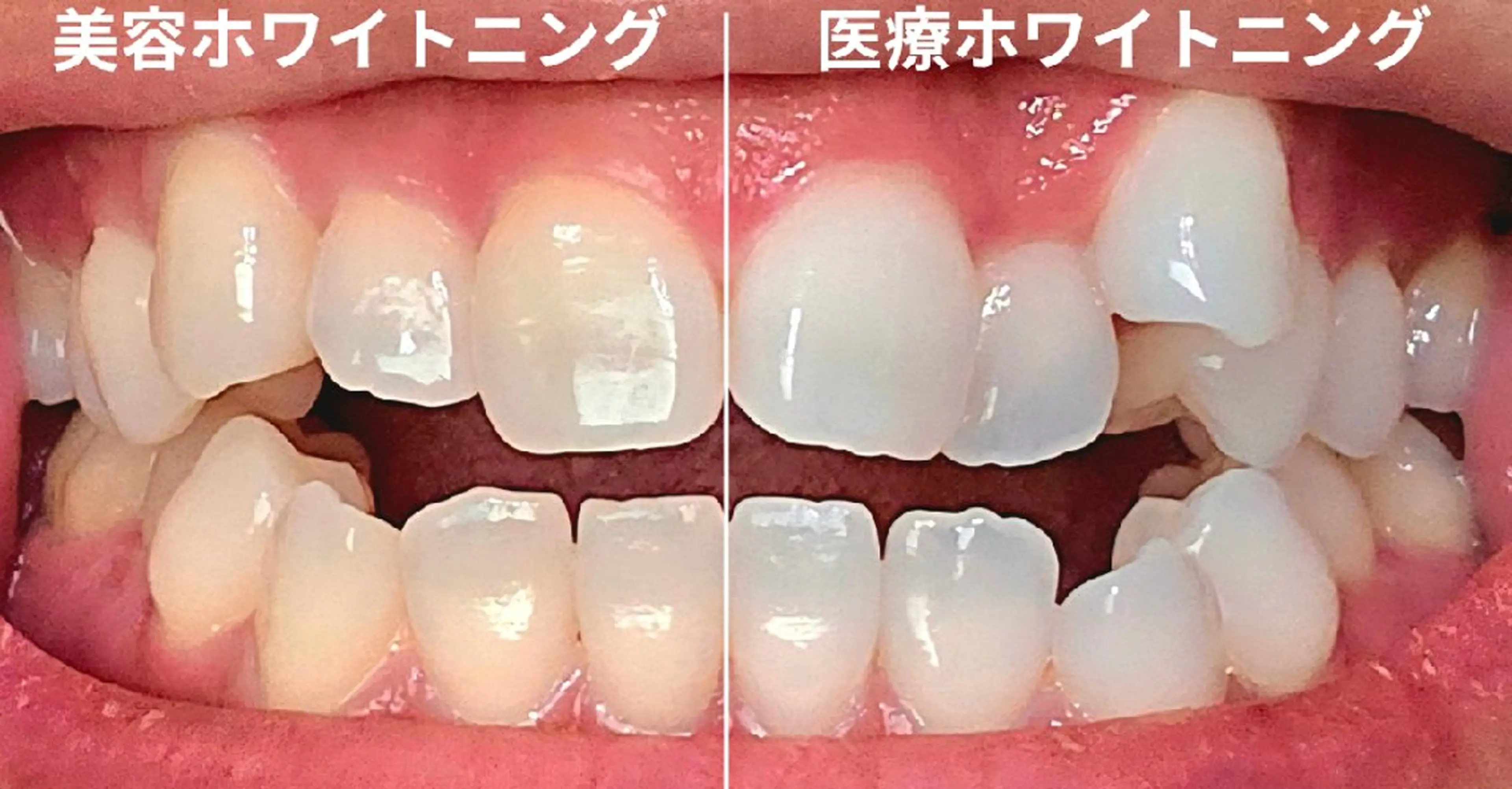 歯科提携セルフダック 宇都宮駒生店のエステ・リラクイメージ