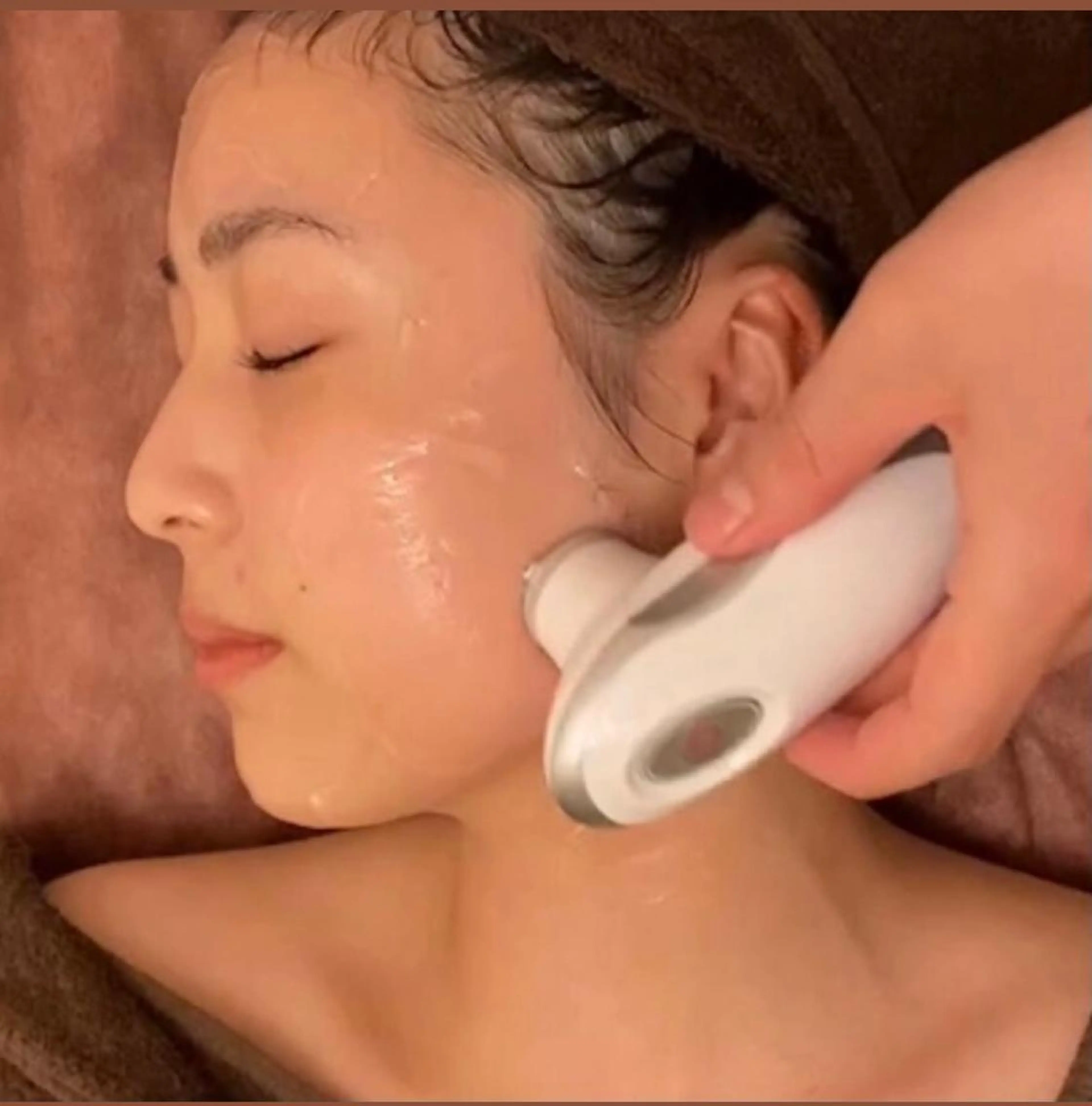 🌿スペシャルメニュー🌿切らないリフトアップ【3Dリフトアップ＋美容鍼(電気付き)】の写真