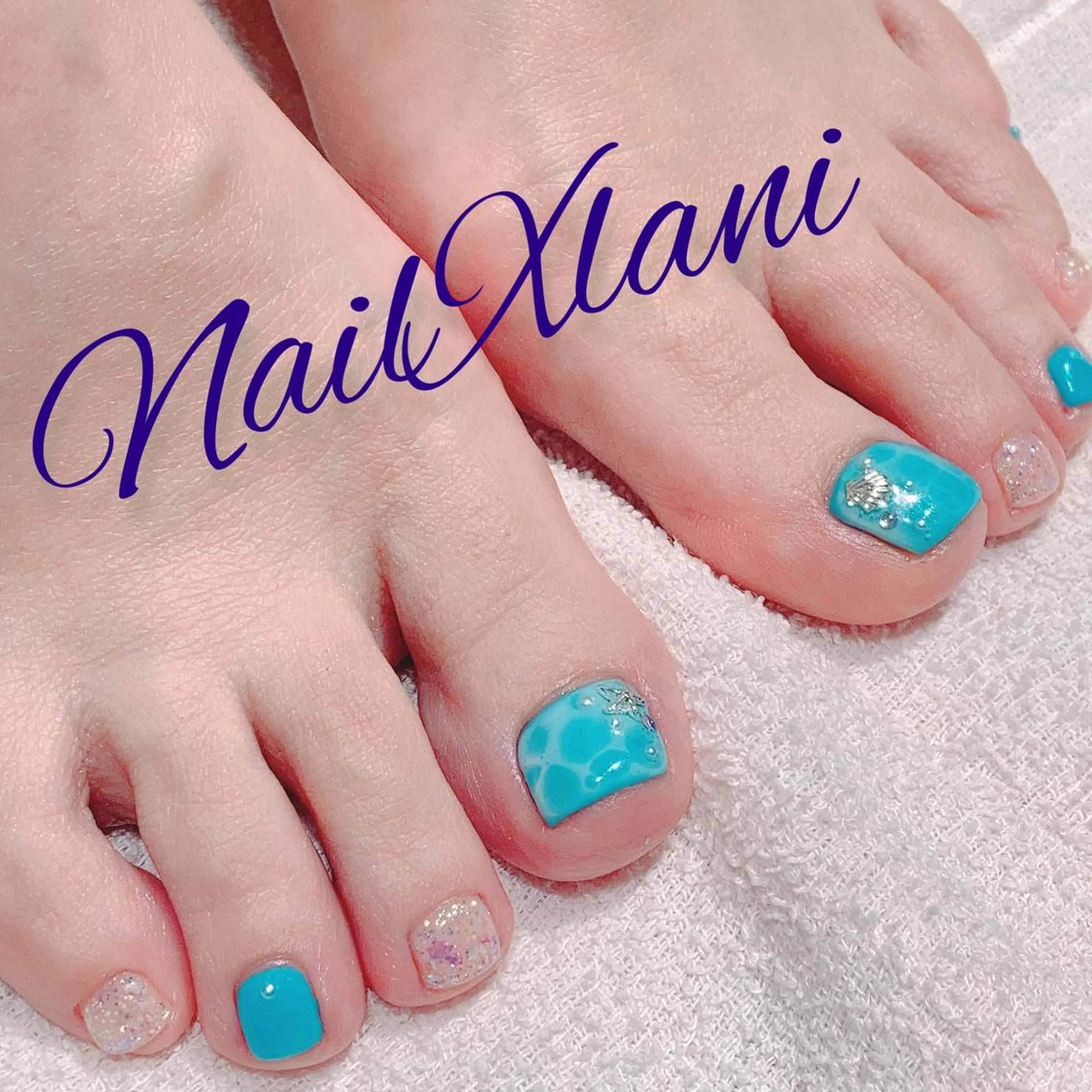 ネイル Nail×Lani 深爪矯正対応◎のネイルデザイン