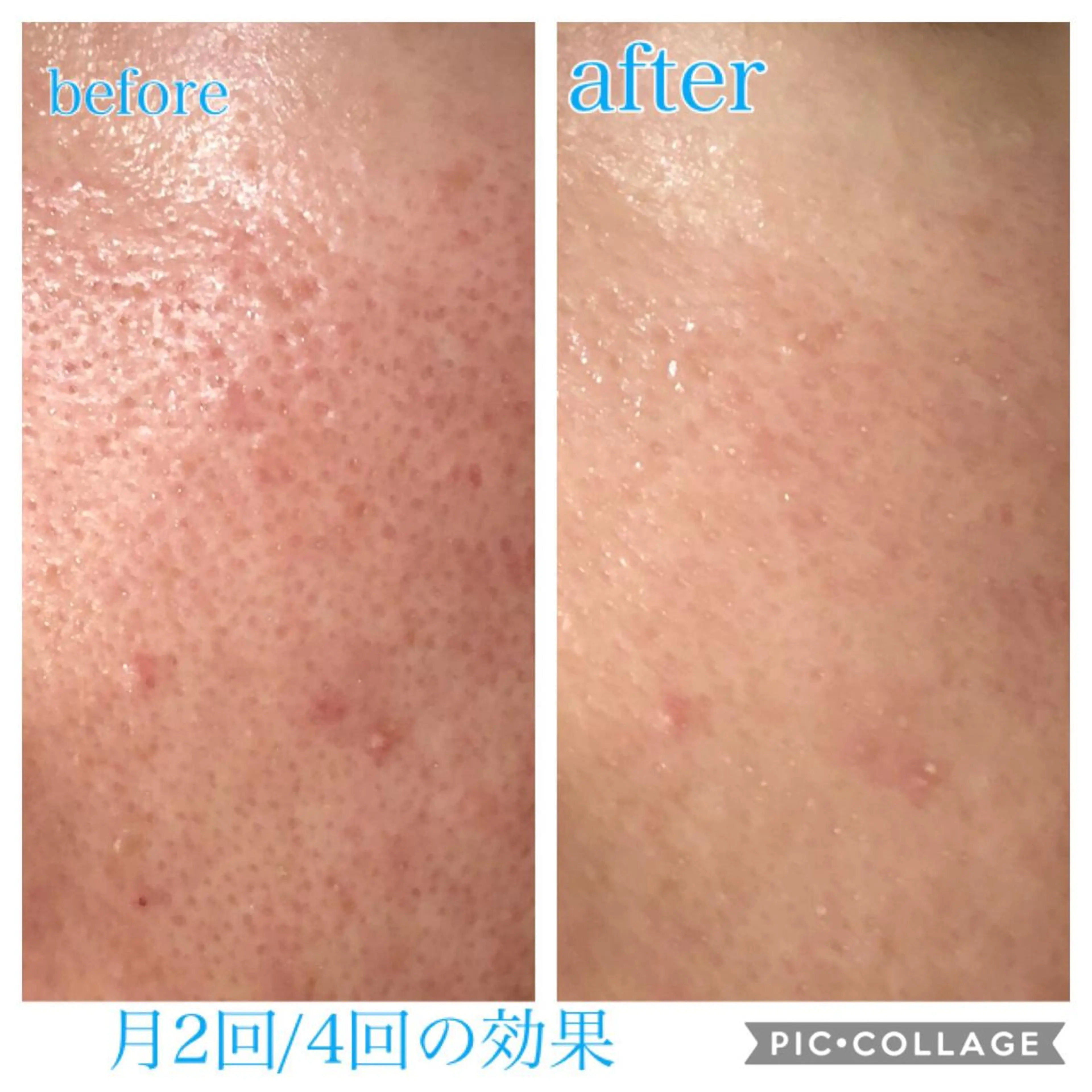 ミディアム カラー パーマ ヘアアレンジ キッズ ネイル マツエク・マツパ エステ リラク Ensor Clair所属・EnsorClair 代表 野口真央のエステ・リラクイメージ